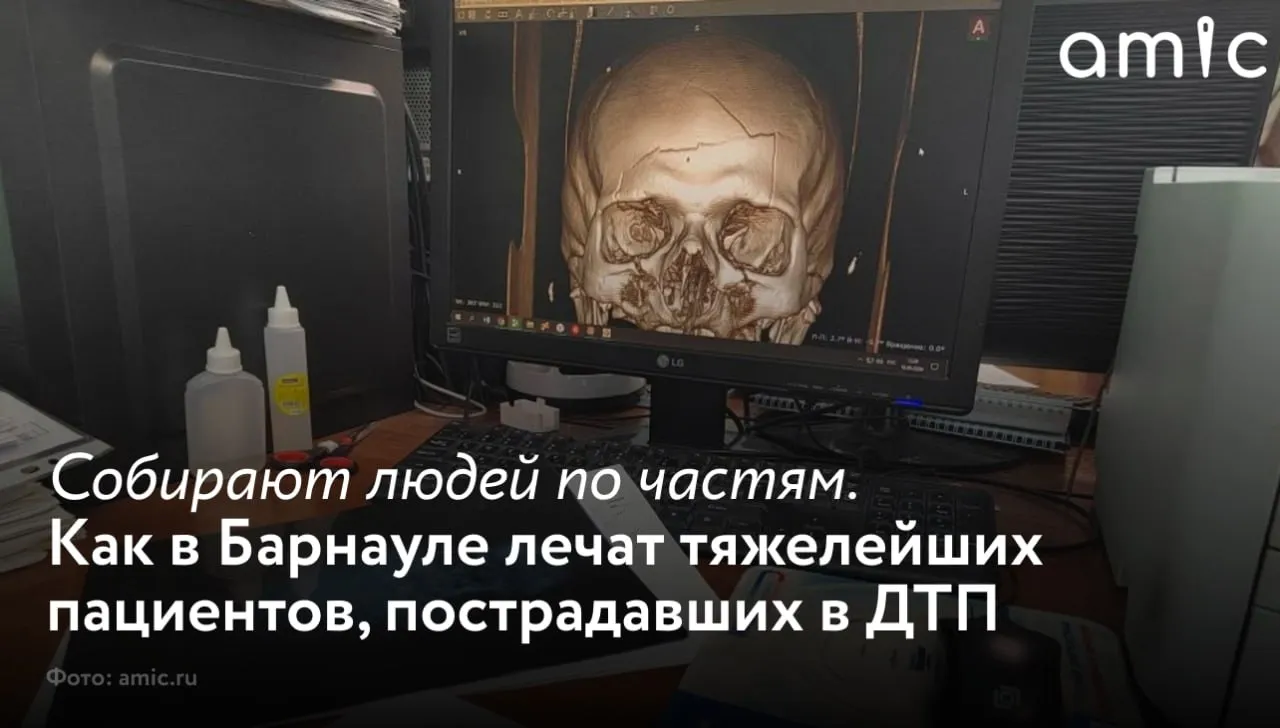 20 мая травматологи отмечают свой профессиональный праздник Это особая медицинская специальность врачи трудятся днем и ночью не прерываясь на праздники и выходные К примеру в Краевой клинической больнице скорой медицинской помощи во многих отделениях и вовсе нет неприемных дней Медучреждение уже много лет работает по скоропомощному профилю спасая людей с колес и ставя их на ноги после тяжелейших травм Отделения травматологического направления составляют большую часть больницы рассказывает главный врач Андрей Макин Каждое специализируется на своей узкой области У каждого свое направление повреждения нижних конечностей и позвоночника крупных сухожилий и верхних конечностей В нейротравматологическом отделении работают с ушибами и повреждениями позвоночника и спинного мозга с черепно мозговыми травмами Есть отделение сочетанной травмы где лечат пациентов с несколькими разными повреждениями Плюс два наших хирургических отделения тоже так или иначе занимаются травмой те же разрывы внутренних органов говорит руководитель О том как больница готовится к теплому сезону когда пострадавших в ДТП становится заметно больше в материале amic ru