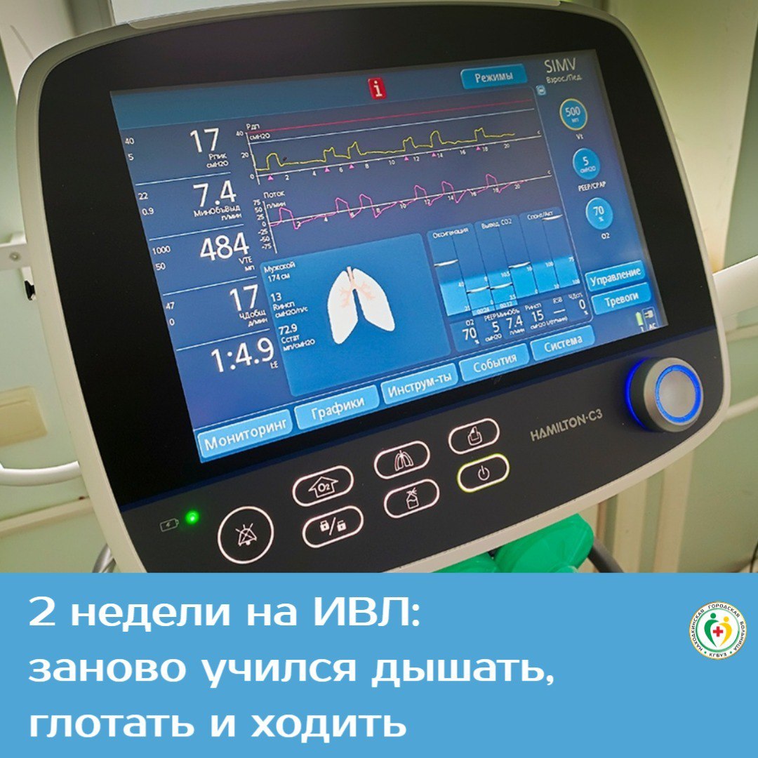 В Находке спасли мужчину получившему тяжелые травмы в ДТП Пострадавшего доставили в Находку с соседней территории в состоянии шока Молодой мужчина не справился с управлением и вылетел с трассы В аварии он сломал половину ребер и кости черепа повредил легкие и головной мозг Три недели за жизнь пациента боролись сотрудники отделений реанимации хирургии и травматологии Две из них больной провел в медикаментозном сне на искусственной вентиляции легких из за крайне тяжелого состояния Чтобы поставить пострадавшего на ноги потребовалось четыре оперативных вмешательства непрерывный мониторинг и коррекция показателей жизнедеятельности и тщательный уход Сейчас мужчина чувствует себя хорошо и выписан домой Дальнейшее восстановление он продолжит в поликлинике   Врачи напоминают водителям о необходимости соблюдать безопасный скоростной режим и предостерегают от управления автомобилем в состоянии опьянения