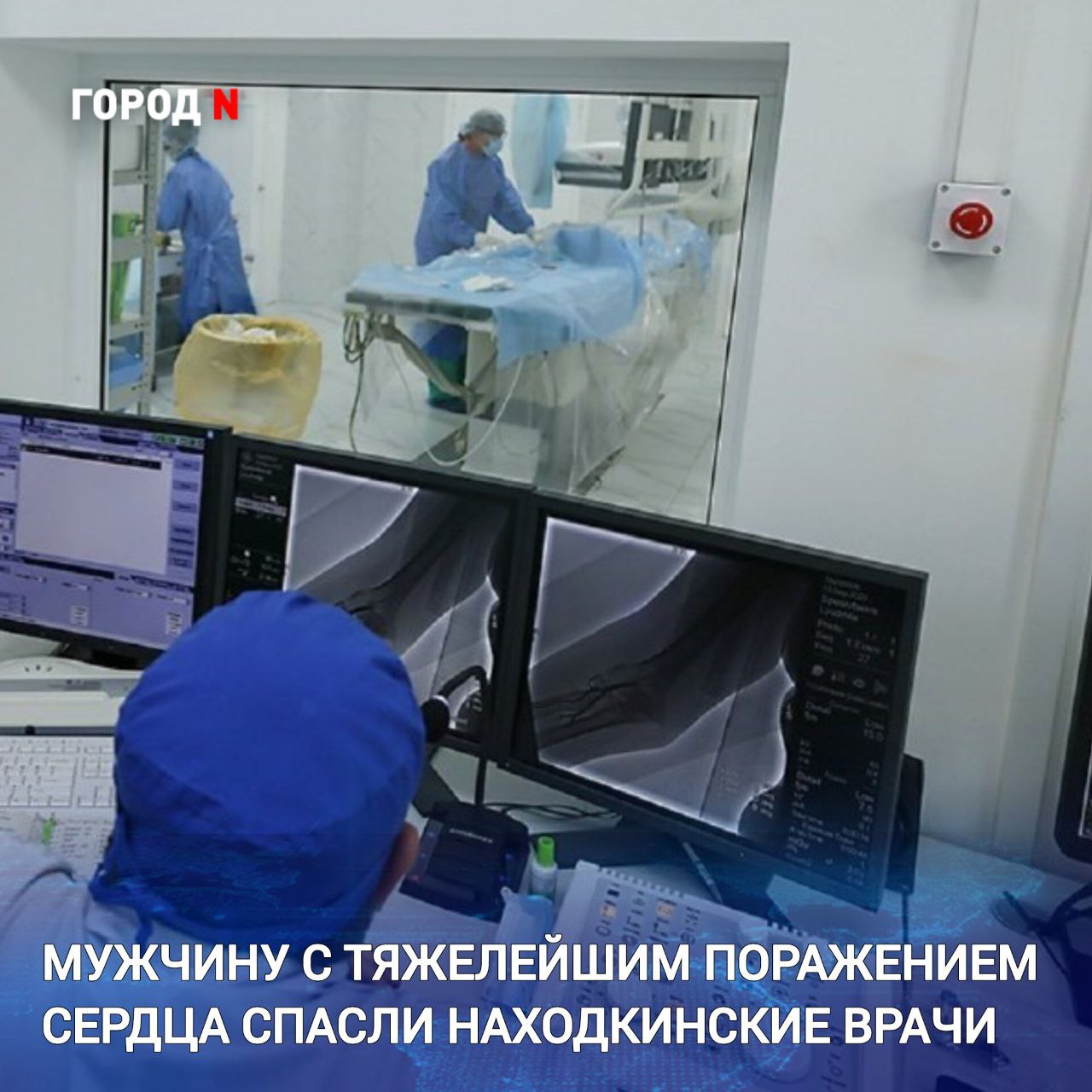65-летний мужчина поступил в крайне-тяжелом состоянии. Ночью он почувствовал себя плохо, но только спустя три часа обратился за медицинской помощью. С критически низким давлением бригада скорой доставила больного в реанимацию.   На фоне обширного   инфаркта у пациента   развился кардиогенный шок   – сердце было не в   состоянии обеспечить   кровоснабжение жизненно   важных органов.  Прогноз при этой патологии неблагоприятный, но мы справились, - рассказал заведующий отделением кардиологии Михаил Шевчук.   Требовалось срочно стабилизировать состояние больного - восстановить сердечный ритм и гемодинамику. Пока больным занимались реаниматологи и кардиологи, рентгенэндоваскулярная бригада готовила операционную с ангиографическим комплексом.    Он дает возможность   оценить состояние   кровеносных сосудов и   проводить ювелирные   хирургические манипуляции   внутри артерий и вен.   Обследование показало, что у пациента полностью перекрыта одна из основных артерий сердца, некроз поразил все слои жизненно важного органа.   Две недели больного выхаживали реаниматологи и кардиологи.     Сейчас он вернулся к повседневной жизни и выписан из стационара.