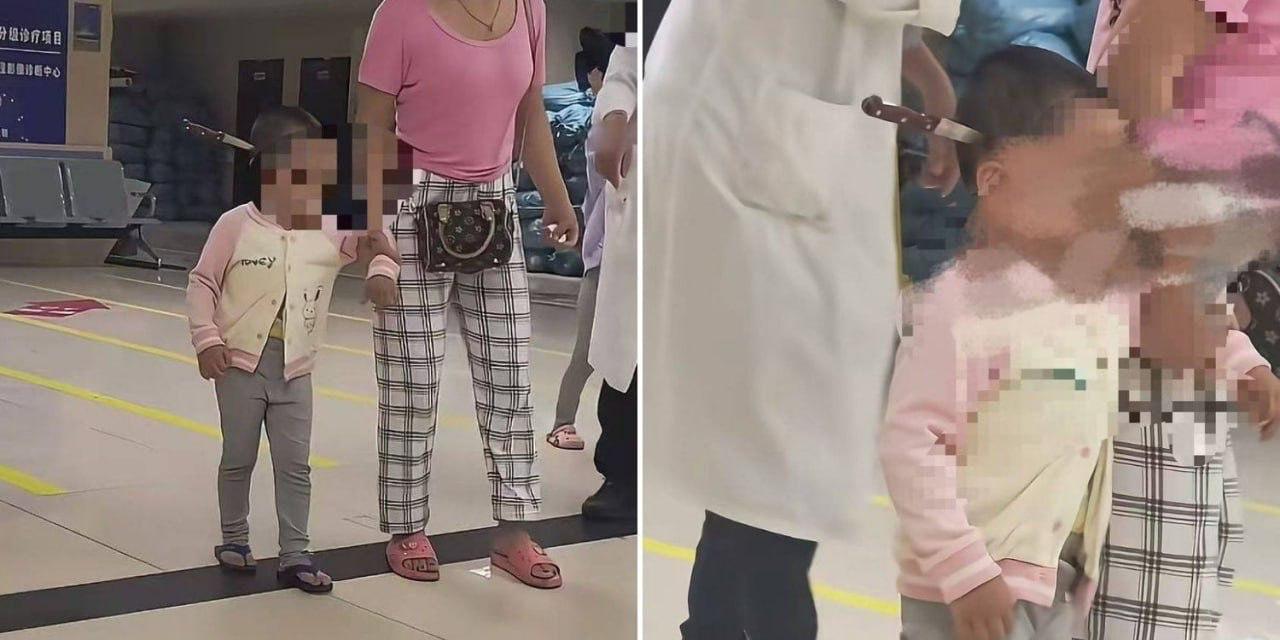 Девочку с 15 сантиметровым ножом в голове спасли врачи в Китае Травму ребенок получил из за своей матери Все произошло во время смены постельного белья Женщина случайно задела простыней нож и он отлетел в голову девочки Из за мягкости черепа травма не привела к смерти моментально Медики успешно извлекли лезвие ребёнок находится в стабильном состоянии сообщает South China Morning Post South China Morning Post дети медики Подписаться на ОТРАЖЕНИЕ