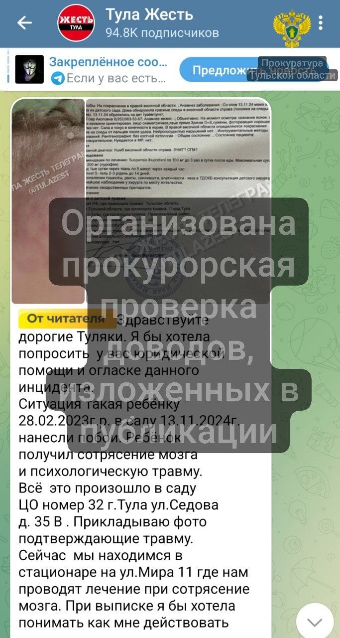 Тульская прокуратура проверит детский сад № 32 после жалобы об избиении ребенка   Недавно в телеграм-канале «Тула Жесть» появилось обращение местной жительницы о том, что ее ребенок якобы подвергся избиению в детском саду № 32 на ул. Седова.  «Ребёнок получил сотрясение мозга и психологическую травму», - написала женщина.    На жалобу обратила внимание прокуратура. В ходе проверки будут установлены все обстоятельства произошедшего, опрошены работники образовательной организации, родители.   В случае, если по результатам проверки выявят нарушения/противоправные действия в отношении детей, будут предприняты меры.