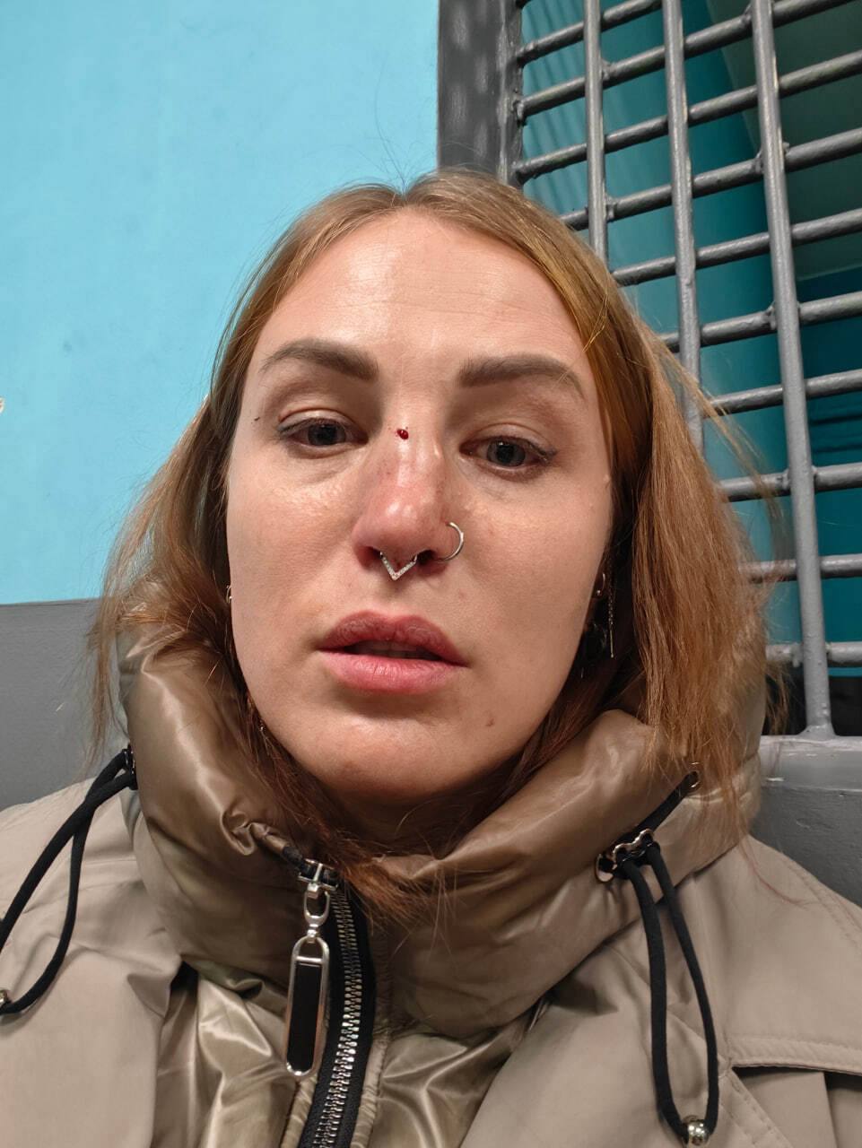 Мужчина сломал девушке нос в московском метро из за отказа дать ему денег об этом пострадавшая рассказала в соцсетях СК возбудил по данному факту уголовное дело о хулиганстве Доклад о ходе расследования запросил глава ведомства Александр Бастрыкин Подпишись на Агентство Москва