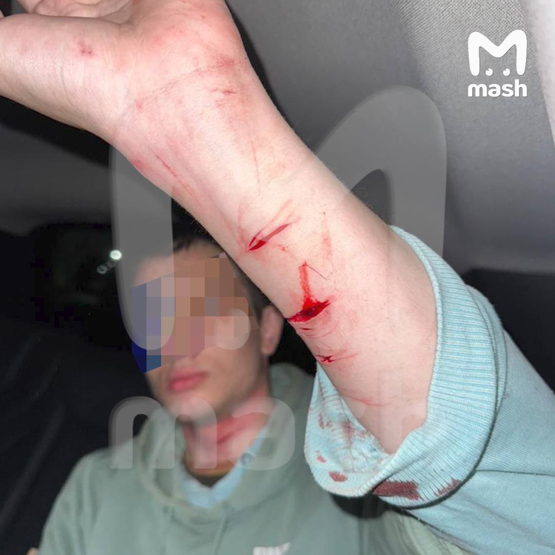 Мужчина напал на двух девочек 13-ти и 16-ти лет во время прогулки в подмосковном СНТ Борисово 25-летний неадекват залил старшую из перцового баллона и ударил железным прутом по голове. Младшая попыталась сбежать. Её нашли родные недалеко в лесу без сознания. Обе в реанимации. 13-летняя пострадавшая в крайне тяжёлом состоянии. Нападавшего задержали. Блокнот Объявления работа Купи/продай авто