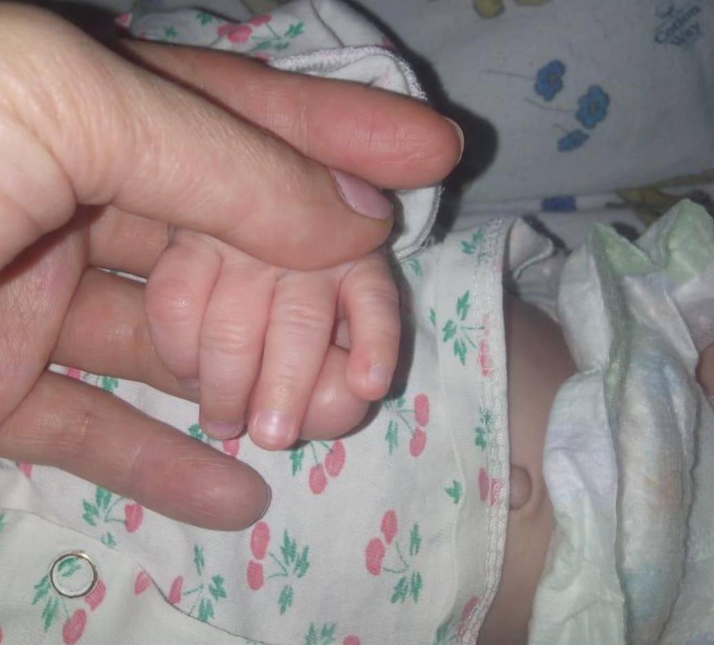 В Хабавске грудничок обварился кипятком под присмотром сестры В Хабаровске семимесячный мальчик получил сильные ожоги горячей водой из радиатора в квартире на Краснореченской улице 25 летняя мать оставила троих детей одних сына и дочек 5 и 7 лет первоклассница за главную и вышла в магазин отец был на работе По предварительным данным средняя девочка случайно открыла кран во время игры облив лежавшего рядом малыша Мальчика госпитализировали полиция проводит проверку семья не на учёте МЧС напоминает никогда не оставляйте малышей без присмотра у источников тепла РОДИТЕЛИ ПРИМОРЬЯ