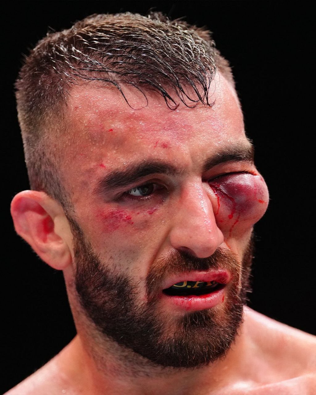 Сегодня в Абу-Даби проходит турнир UFC и для эмиратского бойца Мухаммада Яхьи он сложился крайне неудачно. Спортсмен шесть раз оказывался в нокдауне, после чего рефери остановил бой. Вот у кого суббота не удалась.