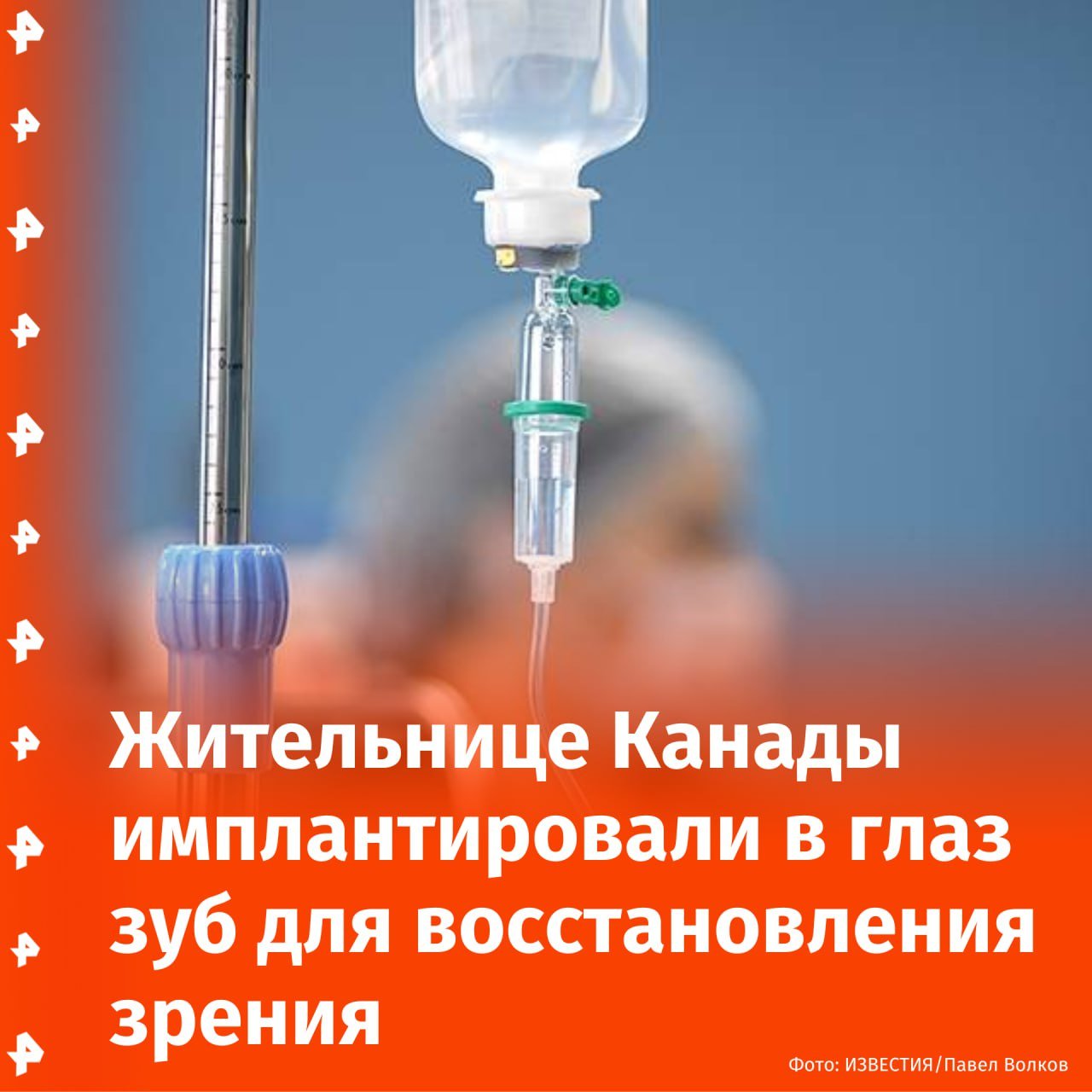 Канадке имплантировали в глаз зуб для восстановления зрения.  Операцию провели в больнице Маунт-Сент-Джозеф в городе Ванкувер, передает телеканал CTV News. Сначала у 74-летней пациентки удалили зуб. После хирурги вырезали отверстие для пластиковой линзы и пришили зуб к внутренней стороне щеки пациента на три месяца.  Смысл имплантации в наращивании слоя поддерживающей ткани. Кроме того, зуб используется, поскольку он хорошо приживается на передней части глаза. При этом организм отторгает любой синтетический материал в глазу.  Операция прошла успешно. Женщина благополучно восстанавливается.        Отправить новость