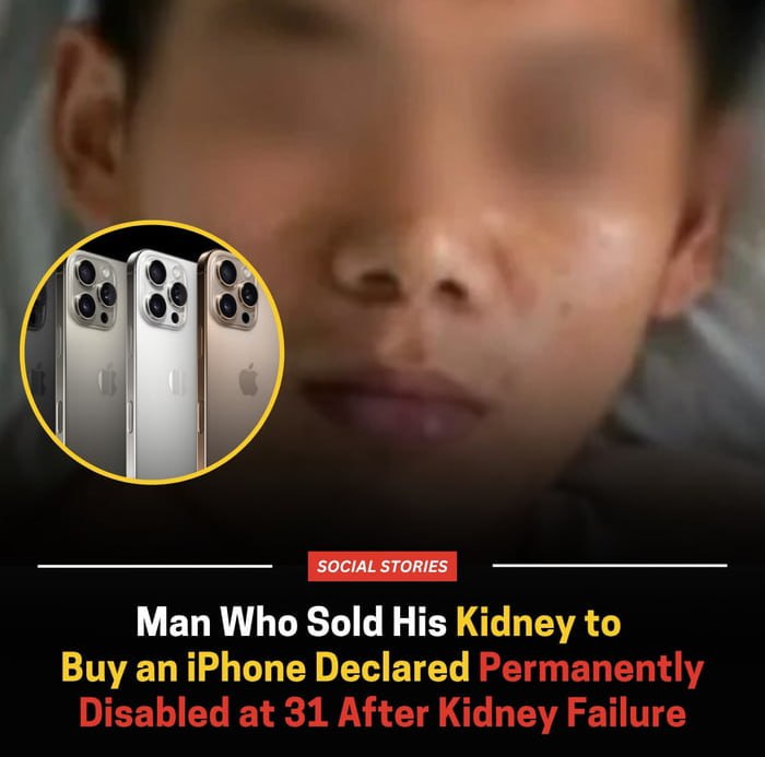 Классика Парень продал почку чтобы купить iPhone но стал инвалидом из за почечной недостаточности Теперь ему была объявлена постоянная инвалидность третьей группы он не может работать и вынужден пожизненно проходить диализ борясь с другими проблемами со здоровьем Ну хотя бы премию Дарвина получил