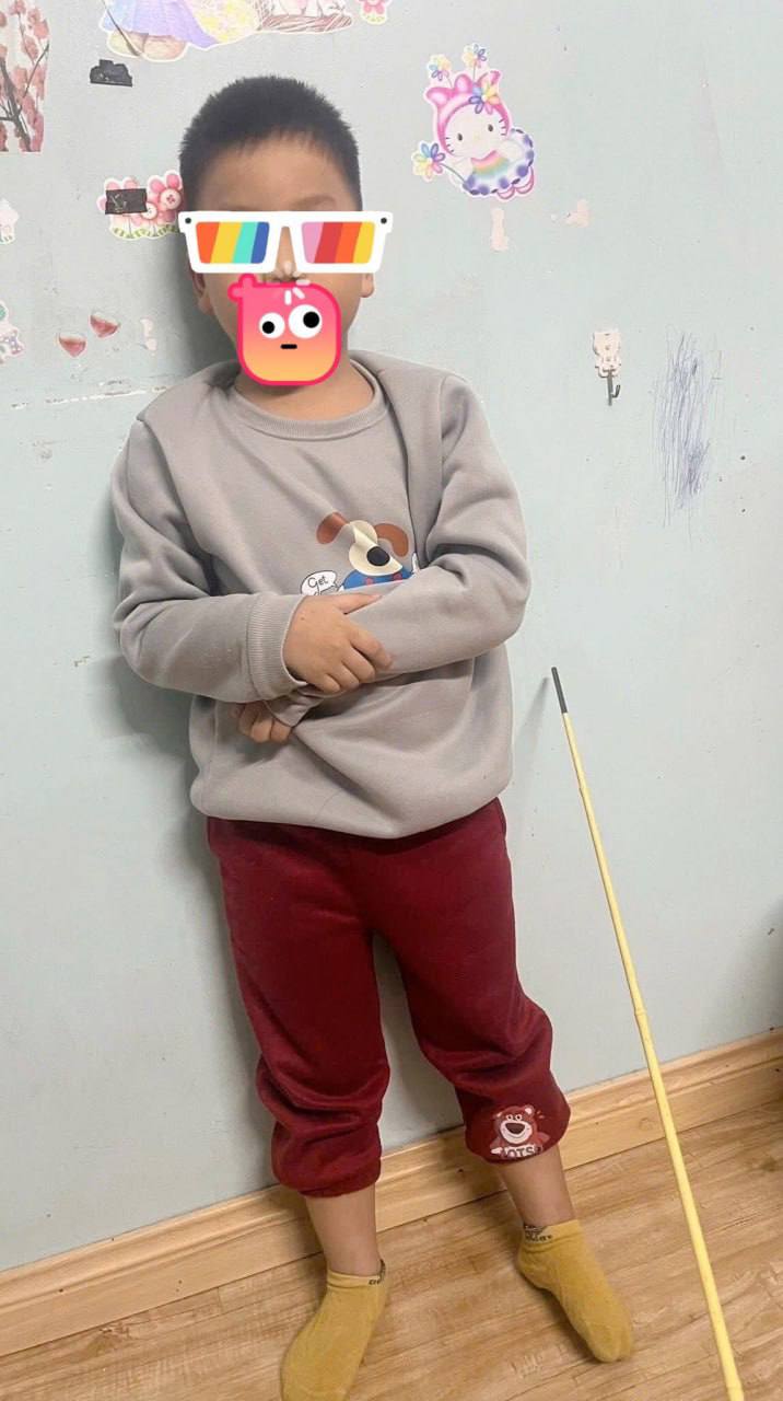 Палка рядом на фото не для антуража Мужчина из Вьетнама пожаловался на сына который в самый разгар дефицита комплектующих умудрился погнуть 50 SSD Samsung по 512 ГБ Пока цены на память видеокарты и процессоры росли быстрее золота ребёнок решил проверить накопители на прочность и переломал целую коробку отцовских SSD По словам владельца сейчас этот набор тянет примерно на 100 млн донгов около 300 тысяч рублей В сети предполагают что часть накопителей ещё можно спасти но шансов на это мягко говоря немного pochinka