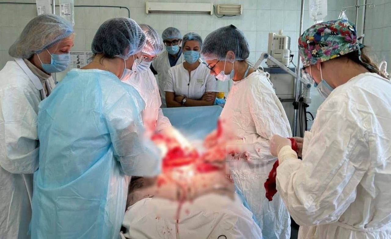 Врачи провели сложную операцию беременной женщине В Клинике ЮУГМУ на 36 неделе беременности женщина с гигантской миомой матки достигавшей 20 см успешно родила здорового мальчика Учитывая риски связанные с миомой врачи провели кесарево сечение и миомэктомию сохранив детородную функцию пациентки Операция прошла с использованием кровосберегающих технологий Теперь мама и малыш уже дома