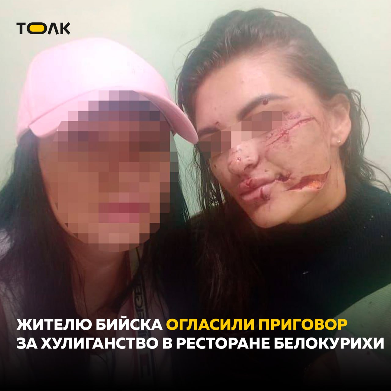 Суд вынес приговор мужчине, который обезобразил лицо девушке в ресторане Белокурихи. Бийчанин приговорен к 4 годам и 10 месяцам лишения свободы с отбыванием в исправительной колонии строгого режима. Напомним, инцидент произошел в августе 2024 года. 38-летний житель Бийска увидел за столиком свою знакомую и подошел поговорить. Между ними возник конфликт, в ходе которого мужчина сначала плеснул девушке в лицо содержимое бокала, а потом ударил им. Осколками стекла он также ранил пытавшегося заступиться за девушку мужчину. ТОЛК