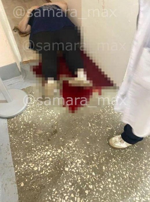 Тело в луже крови что на самом деле случилось в общежитии ПГК в Самаре По Telegram каналам начала распространяться фотография человека в крови Снимок сопровождался текстом Труп девушки в луже крови обнаружен в общежитии Поволжского государственного колледжа По данным нашего источника это было убийство  Источник редакции news63ru сообщил никакого криминала в общежитии не происходило Пожилая женщина вахтер недавно перенесла хирургическую операцию Она оступилась и упала кровь вытекла из за того что разошлись швы Женщина жива
