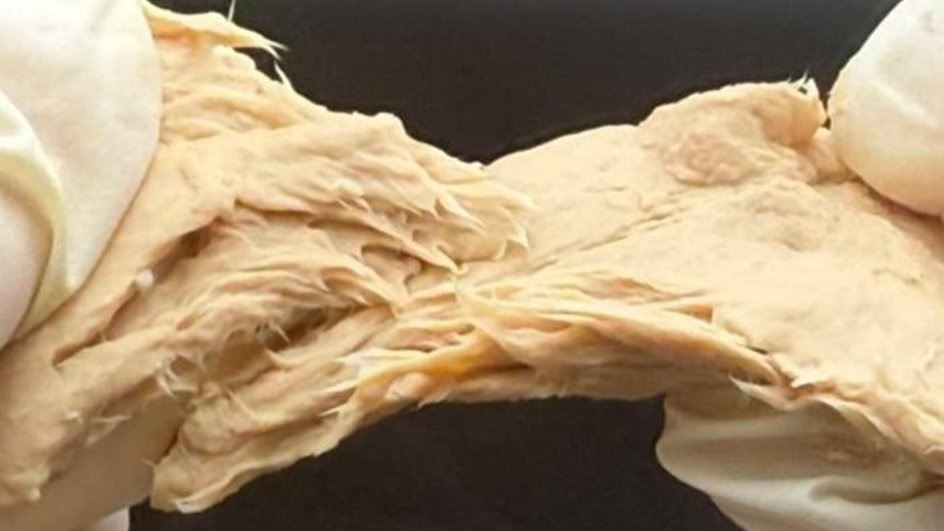 Китайские ученые создали гриб который заменит мясо За основу взяли нитчатый гриб Fusarium venenatum Он имеет вкус и структуру мяса А также одобрен для использования в пищу во многих странах мира включая Великобританию Китай и США Традиционный гриб трудно усваивается из за плотных клеточных стенок а его производство остается ресурсозатратным споры выращивают в гигантских резервуарах на смеси сахара и минеральных добавок Чтобы исправить это ученые отключили у гриба два гена Теперь он легко усваивается быстрее растет и при этом содержит достаточное количество белка Исследователи уверяют что скоро все человечество перейдет на микропротеин из грибов и дрожжей Так как это здоровая альтернатива мясу При этом на их выращивание затрачивается меньше ресурсов а вкус и текстура неотличимы Подписаться на truekpru Читать нас в MAX