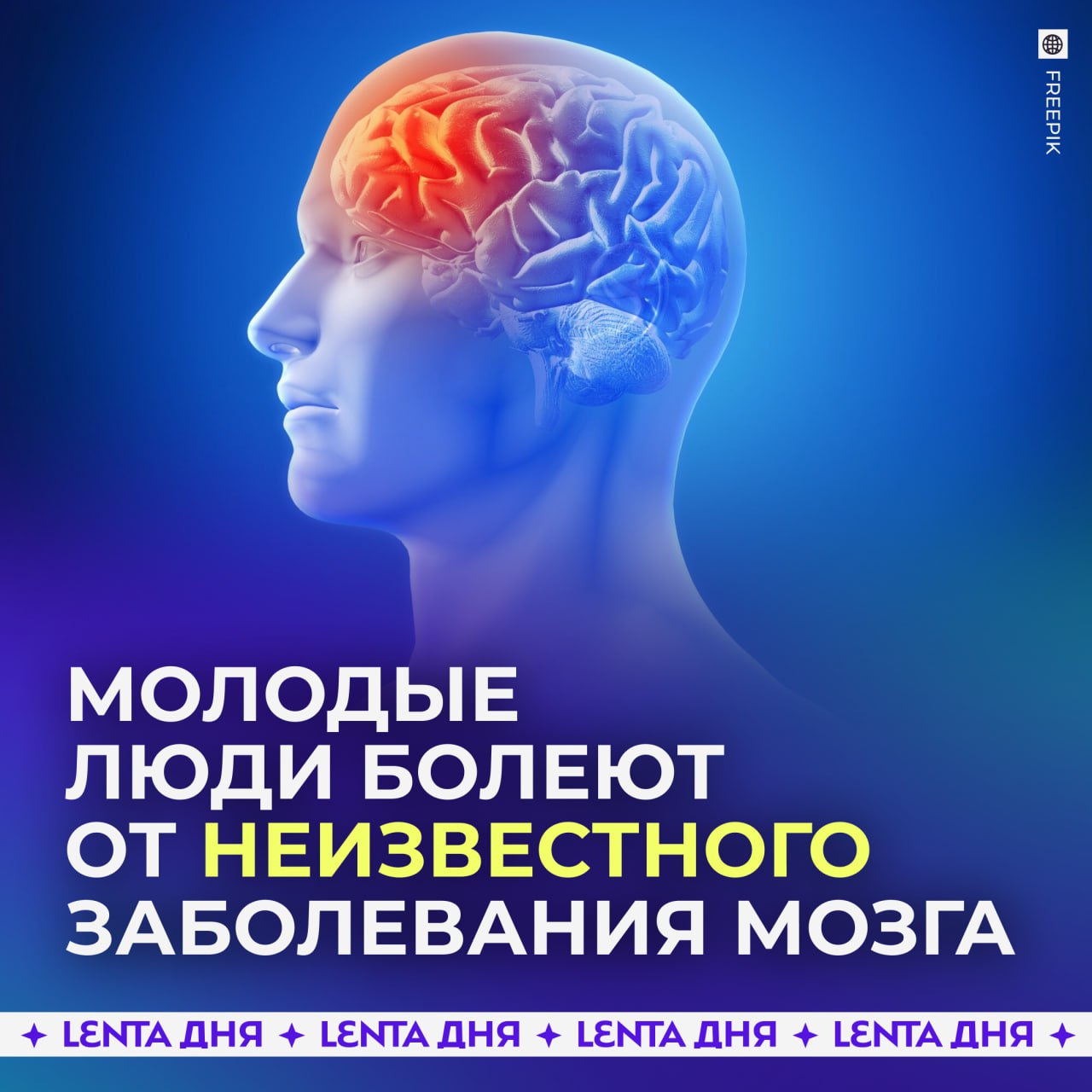 Неизвестное заболевание мозга массово распространяется в Канаде.  Оно поражает преимущественно молодых людей до 45 лет. Симптомы включают тревогу, мышечные спазмы, стук зубов, проблемы со зрением, галлюцинации и нарушения баланса.  Власти отдельных регионов запросили помощь Минздрава для изучения заболевания, так как его причины и методы лечения пока не установлены.    — жесть, всё страшнее и страшнее   — без паники, до России не дойдёт