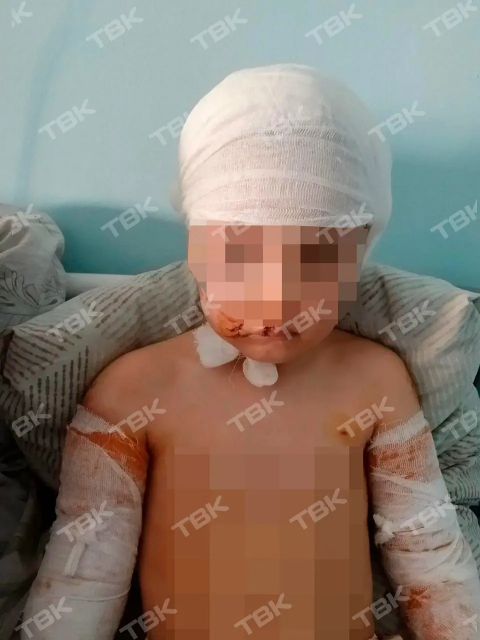 Стая бродячих собак напала на 5 летнюю девочку в Диксоне Отец привёл дочь поиграть на детскую площадку а сам зашёл в магазин В это время прибежали бродячие собаки и накинулись на малышку Они успели много раз укусить её прежде чем появился прохожий который отогнал собак и позвал отца Всю историю рассказали в прокуратуре края Девочке оказали первую помощь в местной амбулатории а потом доставили санавиацией в межрайонную больницу Сейчас она находится в состоянии средней степени тяжести В 2024 году по иску прокуратуры суд обязал местную администрацию организовать отлов собак на Таймыре включая Диксон Однако решение суда исполнено не было В феврале 2026 года по требованию прокуратуры в бюджете Таймырского округа выделили деньги на отлов и провели конкурс по поиску подрядчика Сейчас прокуратура выясняет был ли организован отлов Фото ТВК Проспект Мира в МАХ