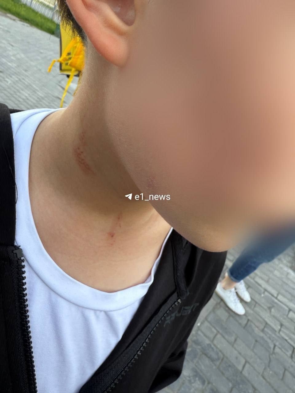 В Екатеринбурге пьяный мужчина избил мальчика, а потом отрицал свою вину. По информации от журналистов Е1, которые передают слова матери пострадавшего, трое детей забежали в подъезд за кошкой и начали шуметь. К ним вышел агрессивный мужчина, который схватил одного из них за капюшон и начал избивать. Очевидцы задержали мужчину и вызвали полицию. По их словам, он был пьян. В отделе полиции нападавшего отпустили той же ночью, взяв лишь письменное объяснение. Свою вину он полностью отрицает. Всё, что ему грозит — административный штраф в размере 5 тысяч рублей. Пострадавшего ребёнка отправили на экспертизу. Подписаться Новости Екатеринбурга