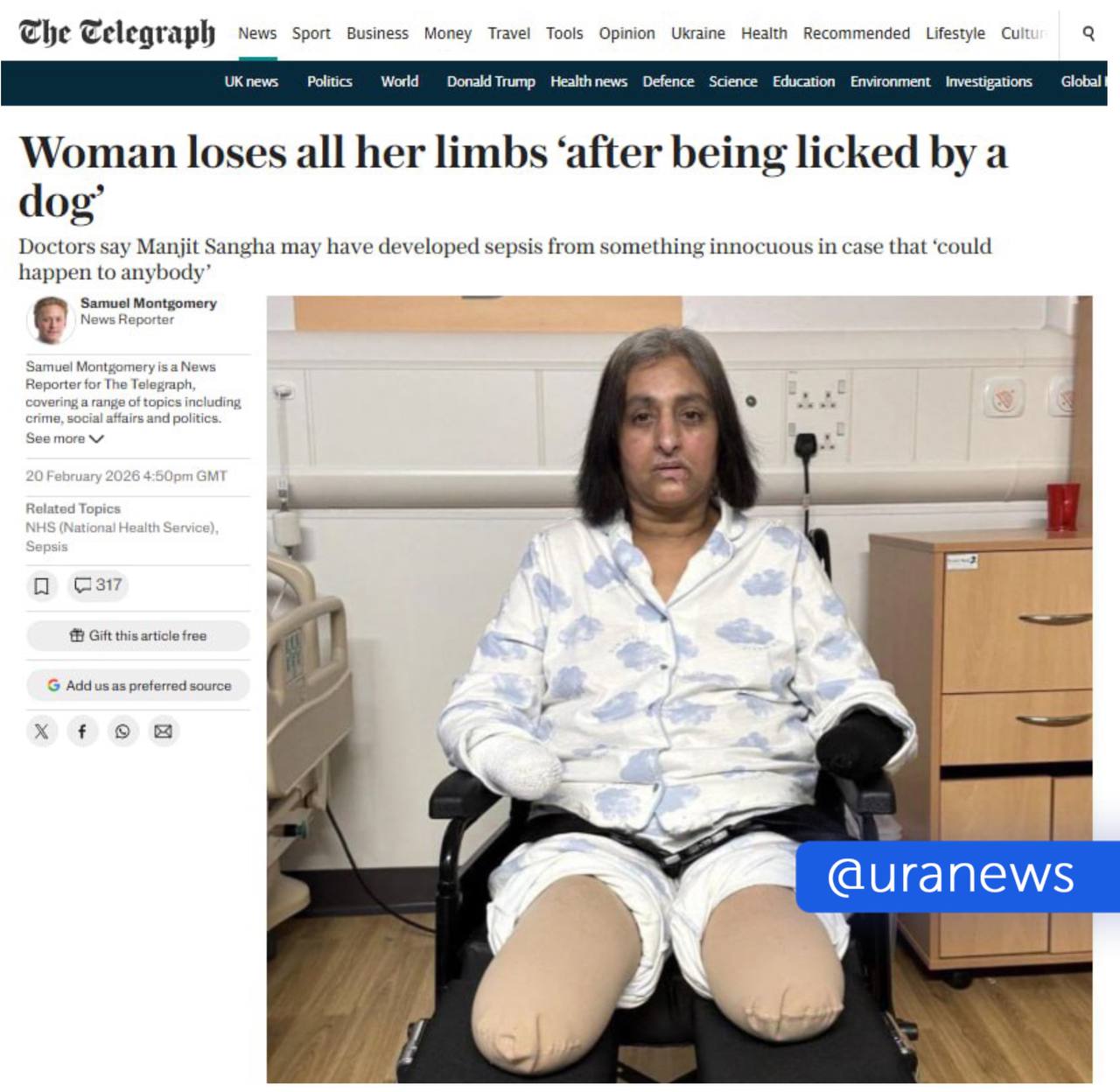 Женщине ампутировали все конечности после того как ее облизала собака У британки развился сепсис из за того что слюна животного попала в рану сообщила газета The Telegraph В июле прошлого года 52 летняя Манджит Сангха поиграла с собакой сходила на работу вернулась домой и почувствовала себя плохо По словам супруга ее состояние ухудшалось стремительно ночью она впала в кому ее госпитализировали Издание отмечает что в реанимации у Сангхи было шесть эпизодов остановки сердца По мере ухудшения состояния хирургам пришлось ампутировать ей обе ноги ниже колена а также обе руки Женщина провела в больнице около восьми месяцев После выписки она заявила что до сих пор не может смириться с ампутацией всех четырех конечностей Подписаться на URA RU мы в MAX