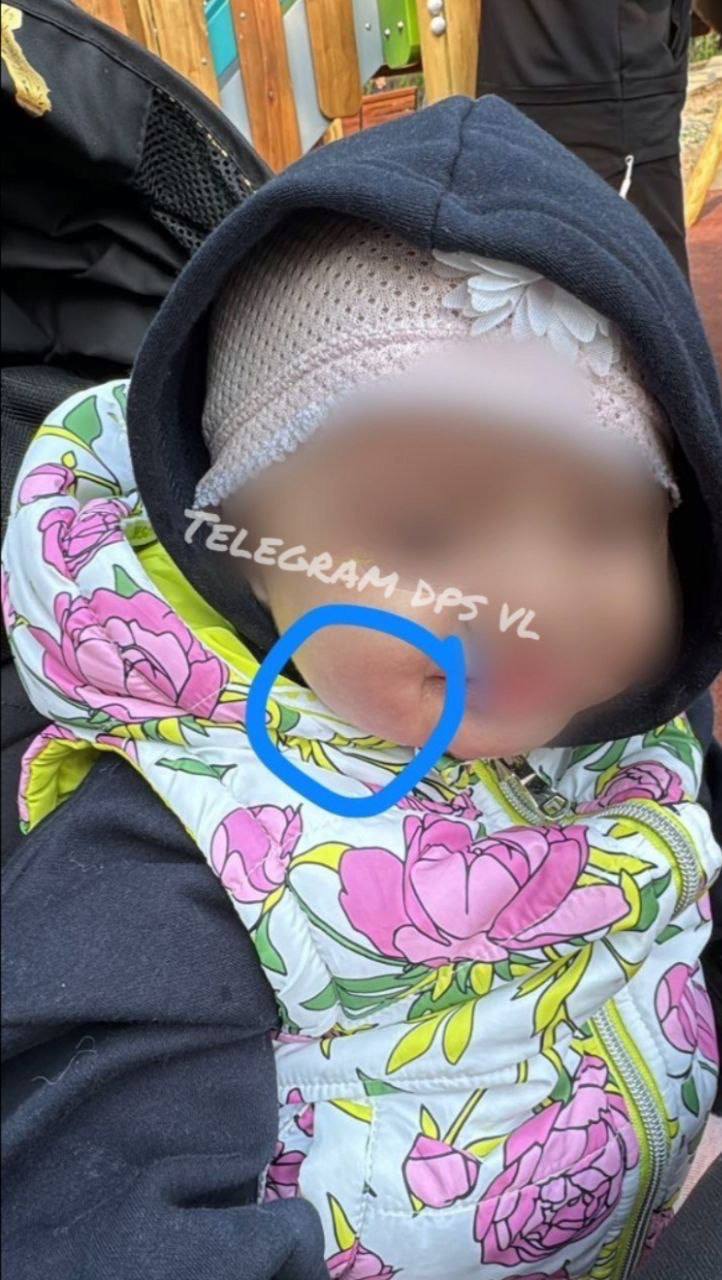 Глава СКР требует отчёт по делу о травмах детей на детской площадке Глава СКР Александр Бастрыкин поручил доложить о результатах проверки по случаю травмирования людей на детской площадке во Владивостоке. Напомним, что 29 мая на детской площадке обрушились качели, после чего пострадали три человека, в том числе 11-месячный ребёнок. Сообщается, что конструкция была установлена с нарушениями и не могла выдержать нагрузку. В регионе началась проверка по этому делу. Александр Бастрыкин поручил руководителю следственного управления по Приморью Эдуарду Трубчику отчитаться о результатах и обстоятельствах происшествия. Контроль за выполнением поручения ведётся в центральном аппарате ведомства. Фото: