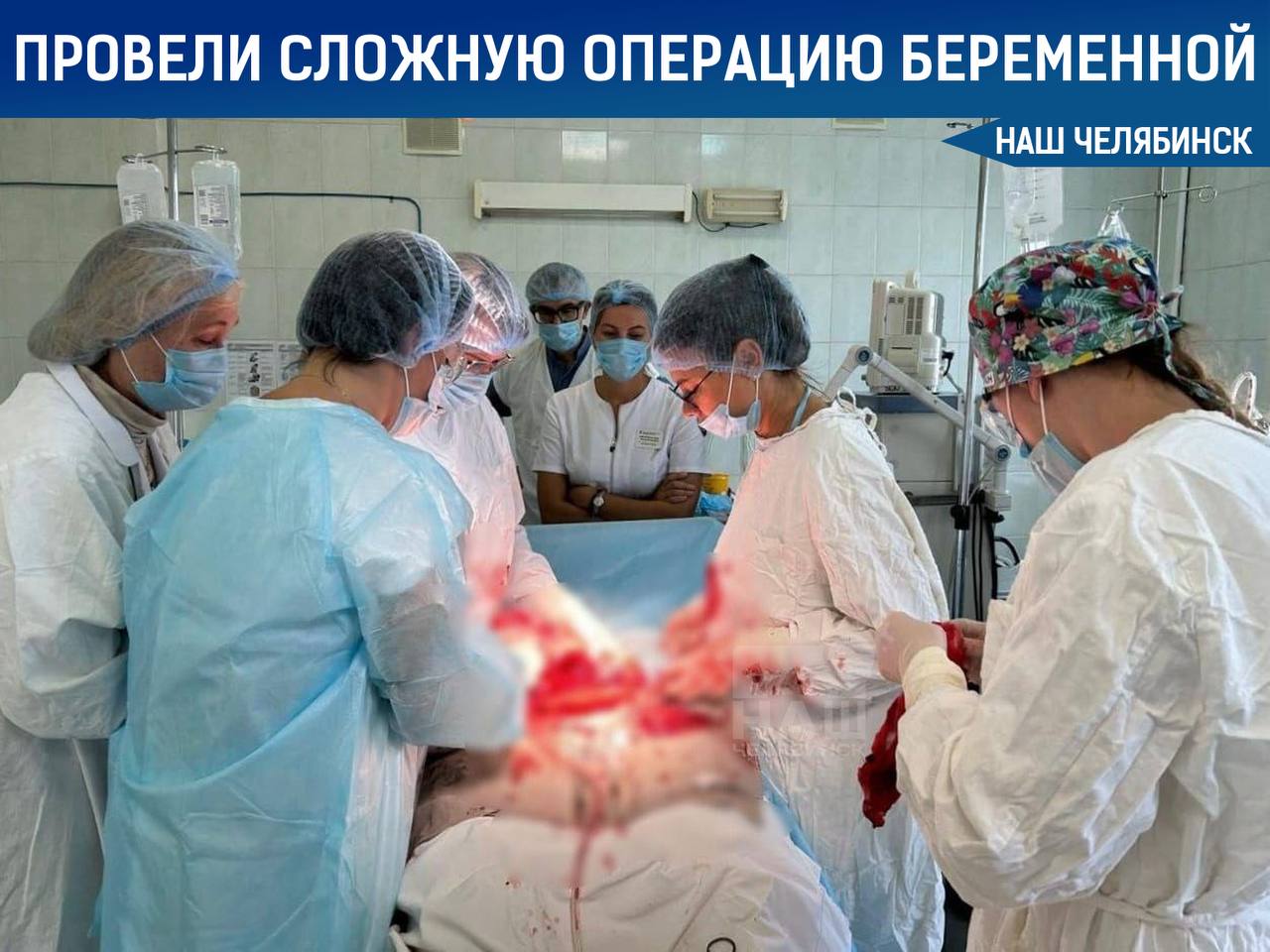 Врачи провели сложную операцию беременной женщине В Клинике ЮУГМУ на 36 неделе беременности женщина с гигантской миомой матки достигавшей 20 см успешно родила здорового мальчика Учитывая риски связанные с миомой врачи провели кесарево сечение и миомэктомию сохранив детородную функцию пациентки Операция прошла с использованием кровосберегающих технологий Теперь мама и малыш уже дома ЮУГМУ Наш Челябинск только самое важное про город Подпишись
