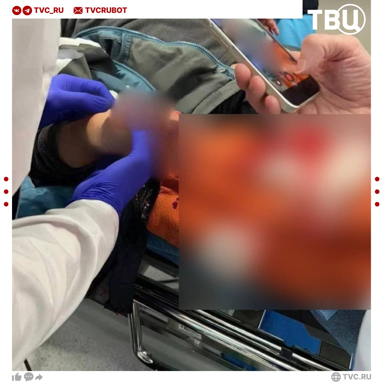 9 летнему мальчику оторвало пальцы взрывом когда он пытался поднять с земли сверток с деньгами в подмосковном Красногорске Деньги лежали рядом с детской площадкой В местных чатах пишут что сработало взрывное устройство Ребенка госпитализировали с ампутацией нескольких пальцев рук Обстоятельства инцидента выясняются Подписаться на ТВЦ в MAX