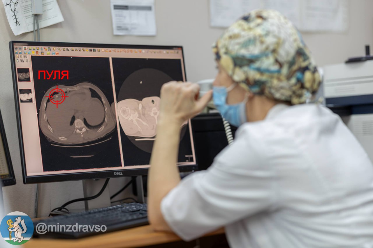 В Екатеринбурге хирурги ЦГКБ 23 спасли мужчину с тремя пулями в груди В состоянии клинической смерти после огнестрела он провёл в общей сложности 38 минут Во время операции сердце пациента дважды останавливалось Сейчас пациент уже проходит восстановительное лечение По данным минздрава региона бригада скорой доставила пациента с проникающими огнестрельными ранениями грудной клетки и повреждением сердца В приёмном отделении дежурная бригада хирургов и анестезиологов обработала раны и извлекла две пули Компьютерная томография показала наличие третьей пули в грудной клетке перелом четвёртого ребра скопление крови в сердечной сумке перикарде гемопневмоторакс и контузию лёгкого Чтобы спасти пациенту жизнь врачи вскрыли его грудную клетку Во время операции мужчина пережил две клинические смерти Чтобы восполнить обильную кровопотерю ему перелили около 1 5 литра донорской крови Первая клиническая смерть длилась 21 минуту Хирурги руками в стерильных условиях ритмично сжимали сердце в раскрытой грудной клетке до тех пор пока оно снова не начало биться Повторная остановка сердца длилась 17 минут но врачи упорно боролись за жизнь пациента и смогли запустить сердце второй раз отмечают в минздраве После операции пациент 9 дней находился на искусственной вентиляции лёгких в отделении реанимации В общей сложности свердловчанин провёл в больнице почти месяц минздрав региона justmediaru