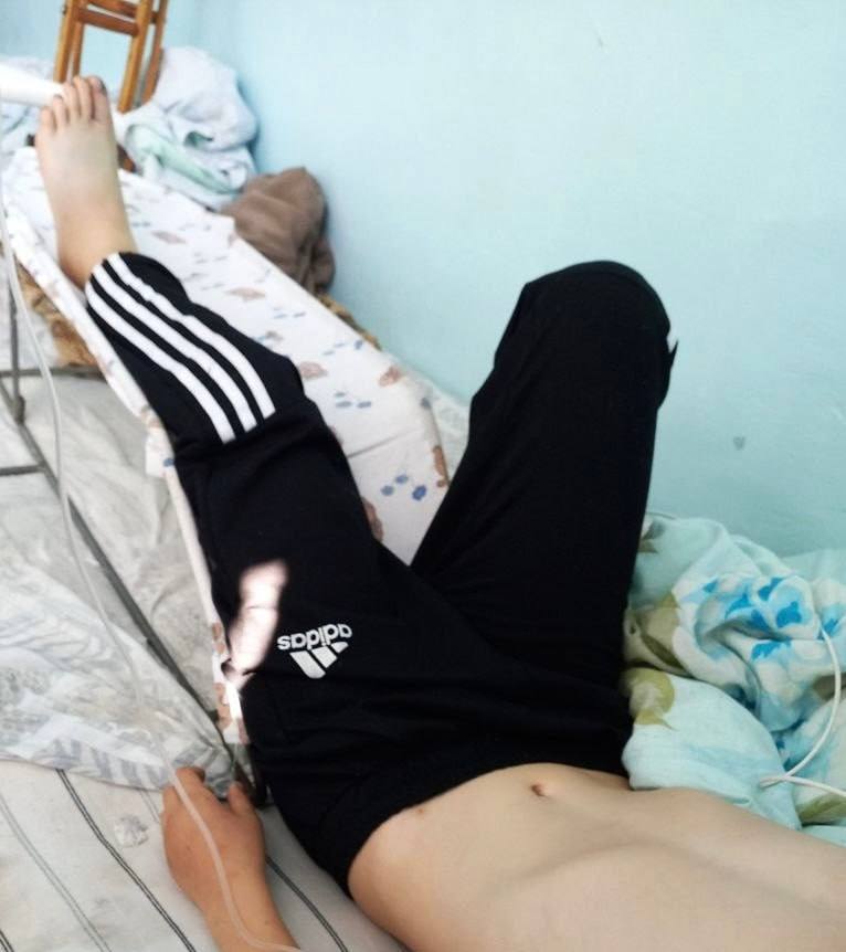 В Закаменском районе врачи спасли 10-летнего мальчика после укуса ядовитой змеи Известно, что инцидент произошел на одной из ферм в местности Грязный Дабан. Ранним утром, выйдя на улицу, он заметил змею и попытался схватить её. Но гадюка укусила ребёнка за ногу. Несмотря на сильную боль, мальчик не сообщил о случившемся сразу и лишь к вечеру его удалось доставить в ближайшее село. Дежурный фельдшер сразу ввёл необходимые препараты и направил ребёнка в районную больницу. Хирурги диагностировали укус гадюки. У ребёнка развился сильный отёк, боль усиливалась, состояние оценили как средней тяжести. Вовремя оказанная помощь помогла избежать осложнений. Сейчас мальчик проходит лечение в стационаре и его жизни ничего не угрожает.