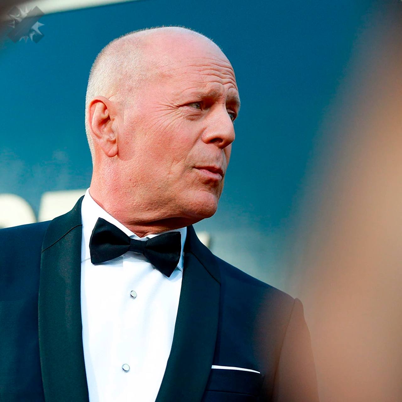 Жена Брюса Уиллиса рассказала последние новости о его состоянии Эмма Хеминг Уиллис заявила что крепкий орешек всё еще узнает ее и детей но не осознает что болен Также супруга актера отметила что в их семье появился особый способ общения между собой Я думаю он воспринимает это как своё нормальное состояние Есть такой термин неврологическое состояние которое сопутствует лобно височной и другим видам деменции анозогнозия Когда мозг не способен понять что с ним происходит Со стороны может показаться что человек отрицает свою проблему Например не хочет идти к врачу говоря Со мной всё в порядке Но на самом деле здесь срабатывает именно анозогнозия Это не отрицание Просто мозг меняется Это часть болезни Физически он по прежнему здесь Иногда я получаю вопросы узнаёт ли он меня Да узнаёт Потому что у него не болезнь Альцгеймера а лобно височная деменция У него есть свой способ общаться со мной и нашими детьми Это возможно отличается от привычных разговоров с близкими но всё равно очень красиво и осмыслено Просто иначе К такому учишься приспосабливаться держись легенда НМШ