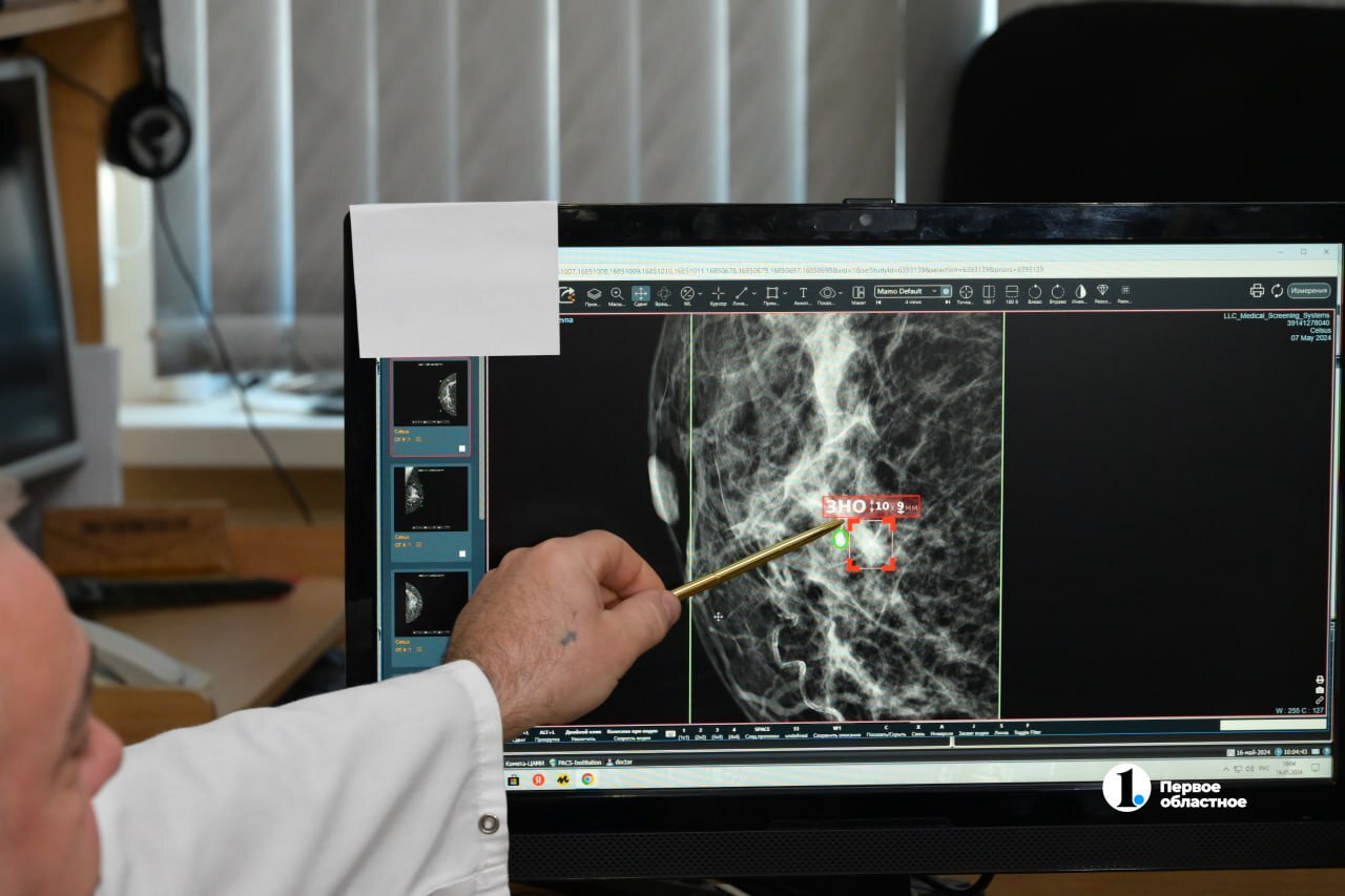 ИИ научился предсказывать рак груди по рентгену за пять лет до болезни Инструмент Clairity Breast анализирует стандартные рентгеновские снимки чтобы выявить потенциальные признаки онкологии на ранних стадиях Эта технология способна оценить пятилетний риск развития заболевания еще до появления первых видимых симптомов и сразу предложить превентивные меры Разработчики уже получили одобрение FDA и в ближайшее время технология начнет внедряться в клиниках США HotCodeIT