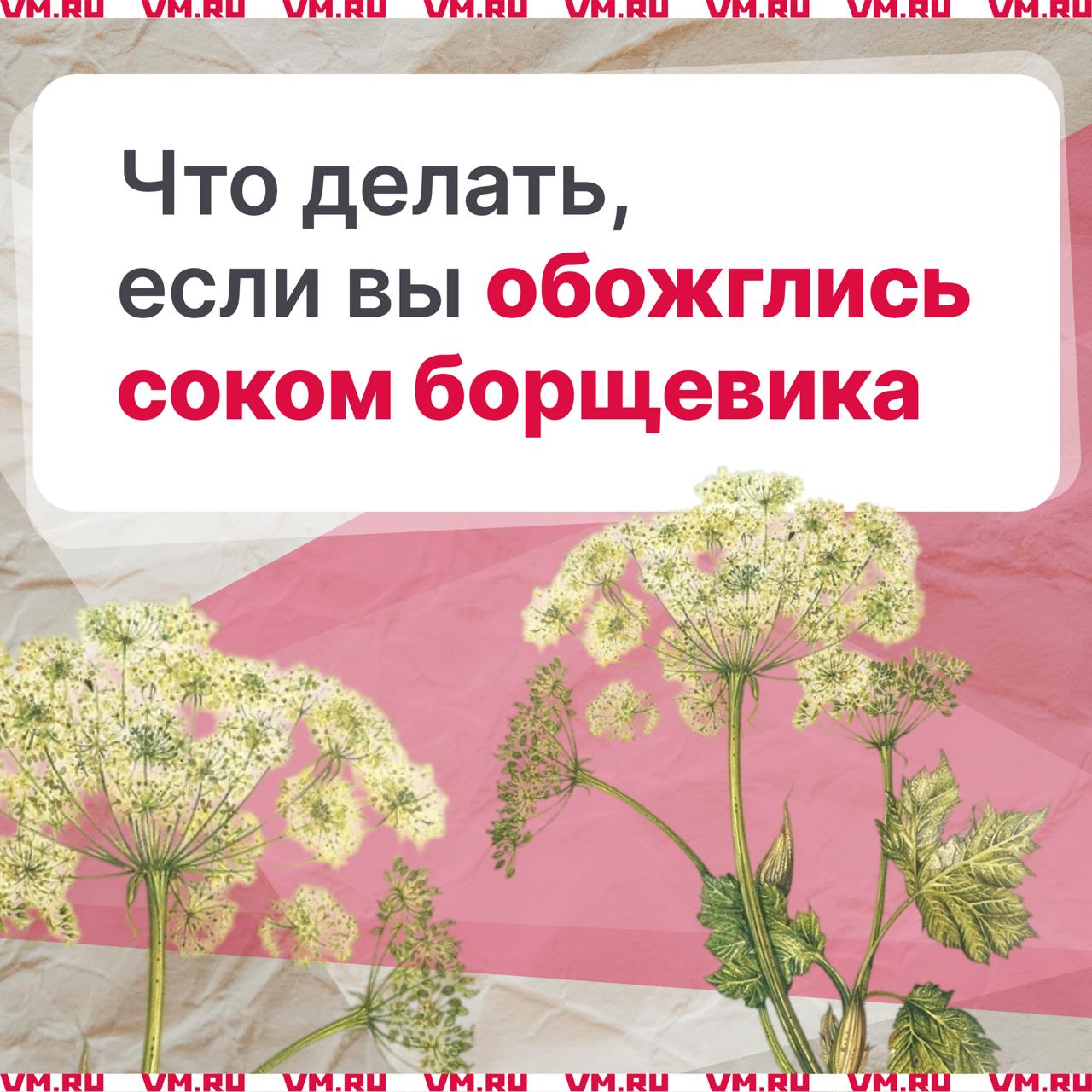 Одно из самых опасных растений средней полосы России — борщевик Сосновского Его сок настолько ядовит, что при попадании на кожу вызывает химический ожог. Это может произойти, если сломать стебель, листья или соцветия растения, и сок вытечет и попадет на кожу. Что делать в случае получения ожога? тщательно промойте кожу водой с мылом, чтобы удалить сок борщевика. Можно использовать хозяйственное мыло или раствор соды. Не трите, а именно промойте; избегайте солнечного света, накрыв место ожога какой-нибудь тканью; обработайте ожог противоожоговым средством; если ожог большой и есть волдыри, обратитесь к врачу. Сохраните, чтобы не потерять Подписаться на «Вечернюю Москву»