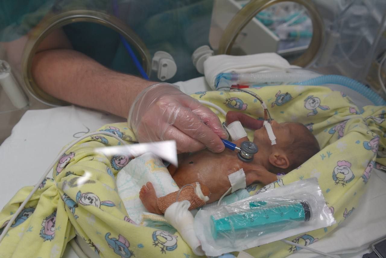 В Перинатальном центре Приморья произошло настоящее чудо медики спасли и выходили новорожденную девочку появившуюся на свет на сроке 24 недели беременности При рождении малышка весила всего 490 граммов Мама девочки Анна поблагодарила врачей за их труд Нет слов чтобы описать нашу благодарность за спасение дочери Ваша работа по спасению и выхаживанию недоношенных деток это настоящий подвиг Низкий вам поклон   Реклама  Поддержать канал Остались вопросы