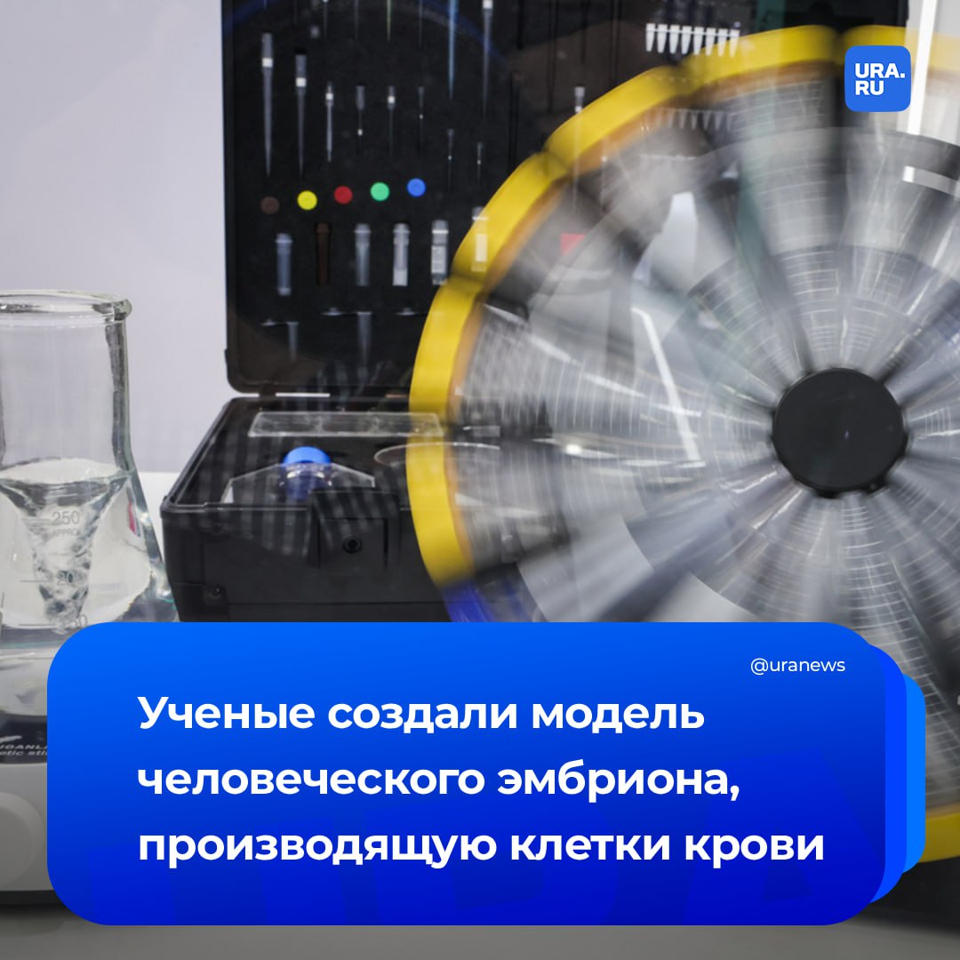 Модель эмбриона человека вырабатывающую кровь создали ученые Для выращивания особых структур сотрудники Кембриджского университета использовали донорские стволовые клетки Гематоиды как их назвали исследователи самоорганизуются и начинают к восьмому дню формировать кардиомиоциты основу сердечной мышцы А примерно через две недели развития в лаборатории они производят кровь имитируя процесс развития человеческого плода говорится в публикации из журнала Cell Reports Ученые считают что это открытие позволит моделировать такие заболевания как лейкемия а также создавать долговечные эритроциты и лейкоциты для трансплантации При этом для выращивания гематоидов используются материалы из любого участка тела человека что расширяет потенциал для медицины Важно что структуры во многих отношениях отличаются от настоящих человеческих эмбрионов и не могут развиться полностью Подписаться на URA RU мы в MAX