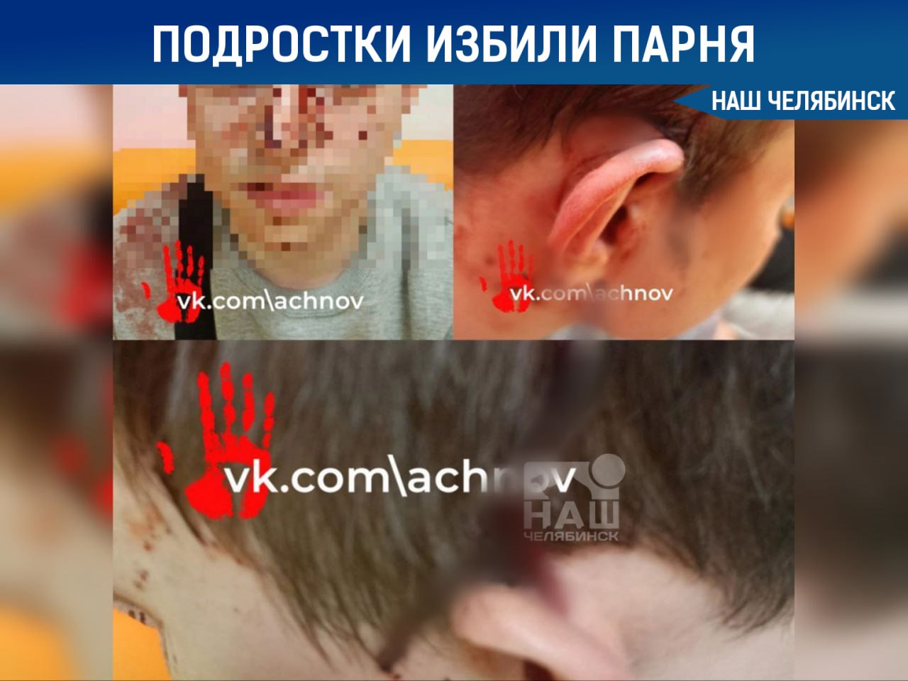 Избили парня, который вступился за мальчика-аутиста  В подземном переходе на Площади Революции толпа подростков напала на молодого человека. По словам его матери, сын вступился за мальчика-аутиста, которого издевались сверстники. В ответ на это нападавшие начали преследовать его и его друга.  Молодой человек, страдающий астмой, попытался убежать, но потерял сознание от удушья, после чего его стали избивать ногами, пишет АЧН. Очнувшись, он получил удар в лоб чем-то железным. Информацию об инциденте передали в полицию, начато расследование.    «Наш Челябинск» - новости без лапши! Подпишись!