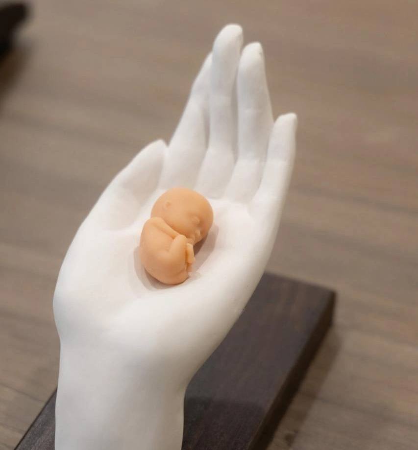 В школах Приморья предложили поставить 3D скульптуры эмбрионов для борьбы с абортами Губернатор Олег Кожемяко заявил что аборты главная причина демографического кризиса и предложил установить в школах макеты эмбрионов напечатанные на 3D принтерах По его словам такие наглядные пособия должны помочь детям осознать что жизнь начинается с зачатия Производством макетов займутся местные предприятия Инициативу поддержал митрополит Владивостокский и Приморский Павел призвав бороться за каждое рождение РОДИТЕЛИ ПРИМОРЬЯ