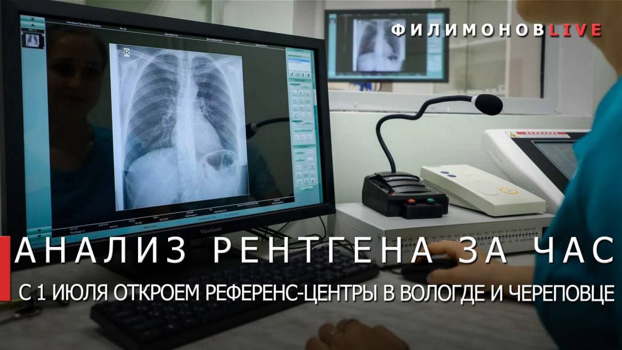 С 1 июля на Вологодчине начнут работать два рентгенологических референс-центра — в Вологде и Череповце. Теперь вологжане могут пройти медицинское исследование – КТ, МРТ, флюорографию, маммографию – в своей ЦРБ и в течение часа получить заключение от специалистов из крупных городов. С 9 июня начнём тестирование системы, а с 1 июля — запуск. Референс-центры открываются: в Вологодской областной детской клинической больнице в Вологде; в Вологодской областной больнице №3 в Череповце. Отделения уже обеспечили современным оборудованием, автоматизированными рабочими местами и специалистами. Череповецкий центр будет обслуживать западные муниципалитеты региона и сможет обрабатывать свыше 50 тыс. снимков в год. Вологодский — более 106 тыс. снимков в год от жителей восточных округов. Референс-центры будут работать круглосуточно, охватывать и детское, и взрослое население. Главный принцип — описание снимков день в день, с учётом аналитики. Особенно это важно для пациентов из отдалённых территорий, где нет узкопрофильных специалистов. Вместе с этим продолжаем системно усиливать здравоохранение региона. В конце лета начнём капитальный ремонт Вологодской областной больницы №1 — её текущее состояние недопустимо для областной столицы. Всего в перечне — ремонт 103 объектов здравоохранения, закупка 10 единиц тяжёлого оборудования, а также передвижного медкомплекса и 2 стоматологических кабинетов. В муниципалитетах появятся 18 модульных ФАПов, и ещё 12 будут капитально отремонтированы. Общий объём финансирования сферы здравоохранения в этом году составляет 45,1 млрд руб. Эти средства предусмотрены Территориальной программой обязательного медстрахования, федеральным и областным бюджетами, а также включены в реализацию программы «Стратегия 2.0». Объединяем технологии, кадровый потенциал и управленческие решения, чтобы вологжане получали качественную медицинскую помощь быстро и в любом уголке области. Подпишись – Филимонов LIVE в Телеграм Подпишись – Георгий Филимонов в ВК