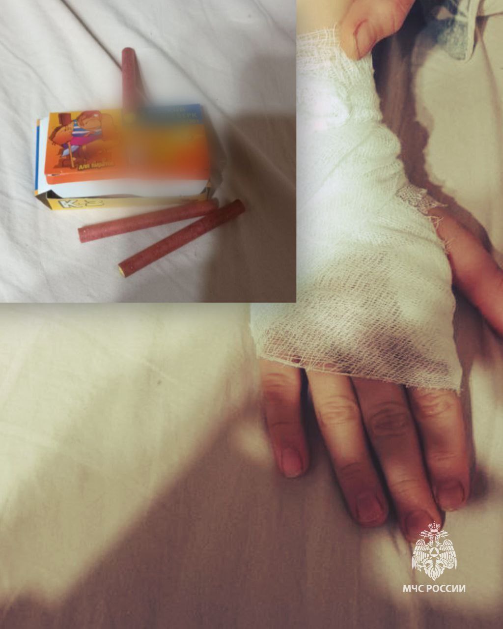 В Удмуртии ребенок получил ожоги от петарды Инцидент произошёл вечером 29 декабря в Можге Мама купила бомбочки 10 летнему сыну но запретила пользоваться ими без ее присутствия Мальчик не послушался тайком забрал их с собой на улицу Гуляя с друзьями он едва успел поджечь петарду как она моментально разорвалась в руке К счастью обошлось без серьёзных травм медики осмотрели и отпустили ребёнка домой с ожогом второй степени МЧС России предупреждает покупайте пиротехнику только в специализированных магазинах с лицензией тщательно ознакомься с инструкцией перед использованием запускай изделия на безопасном расстоянии не держи в руках избегай направления фейерверков в сторону людей и зданий храни подальше от детей и запрещай им пользоваться без вашего присутствия Подписывайся на МЧС Удмуртии МАХ ВК МЧС России в MAX ВК