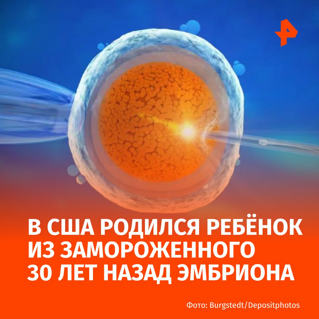 "Самый старый ребёнок" родился в США из замороженного 30 лет назад эмбриона. Об этом пишет журнал MIT Technology Review. Супружеская пара "усыновила" эмбрион у 62-летней Линды Арчерд, которая в начале 90-х годов прошла процедуру ЭКО вместе со своим мужем. В результате у Линды и её супруга родилась дочь, которой сейчас 30 лет. У Арчерд все еще оставалось три эмбриона. Когда они с мужем развелись, женщина получила право опеки над эмбрионами и продолжила выплачивать ежегодную плату за их хранение. Но когда Арчерд приблизилась к менопаузе, у нее возникли сомнения по поводу необходимости сохранения будущих детей. Она отказалась от анонимного донорства и отдала свои эмбрионы на "усыновление" другим людям. Семейство Пирс уже семь лет не могли завести ребёнка. Именно их подобрали в качестве будущих родителей. Из трех замороженных эмбрионов Арчерд два оказались жизнеспособными и были перенесены Линдси Пирс. Один был успешно имплантирован, в результате чего на свет появился здоровый мальчик Таддеус Дэниел Пирс. Он получил прозвище "самого старого ребенка", поскольку эмбрион был создан, когда его родители были еще совсем маленькими. МАХ Отправить новость