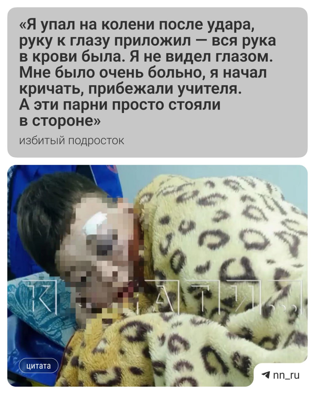14 летний школьник напал на 15 летнего знакомого в Ветлужском районе Драка произошла прямо в коридоре школы Отец пострадавшего мальчика рассказал программе Кстати что его сына вызвали из класса четверо ребят Один из них ударил его сына чем то тяжёлым У ребёнка несколько переломов лобной кости ушиб глаза и другие травмы Руководство школы удивилось случившемуся с зачинщиком драки раньше проблем не было на учёте он не состоит Теперь на подростка возбудили дело об умышленном причинении тяжкого вреда здоровью Подпишись Предложи новость