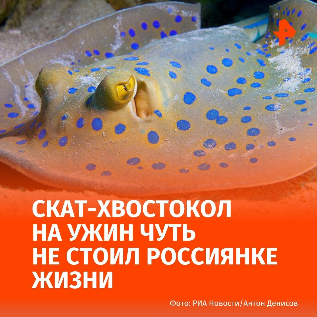 Сын привез своей матери ската хвостокола чтобы приготовить на ужин в качестве деликатеса Женщина укололась и попала в больницу в Подмосковье с сильным отеком Рыбу женщина собиралась приготовить на ужин но во время разделки поранилась ядовитым шипом Женщина не подозревала об опасности поэтому в течение двух суток пыталась справиться с симптомами самостоятельно обрабатывала пальцы йодом и принимала жаропонижающее Яд вызывает спазмы паралич мышц и снижение артериального давления В природе удар ската хвостокола если вовремя не оказать помощь может вызвать смертельный исход При поступлении пациентке сразу была проведена медикаментозная терапия чтобы как можно быстрее нейтрализовать яд и предотвратить его разрушительное действие на организм сообщили в региональном Минздраве После терапии состояние женщины значительно улучшилось Сейчас она уже дома РЕН ТВ в Telegram в MAX