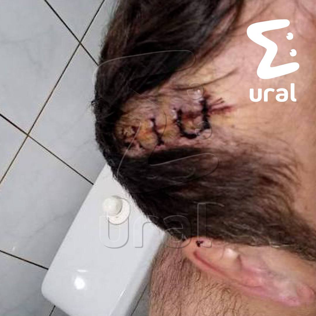Мужик из Невьянска пробил соседу голову ломом за просьбу не воровать у него воду. Оба героя этой истории — Димоны. Один возвращался из магазина и увидел, как второй поливает плитку. Попросил его переставить трубу по словам пострадавшего, через неё сосед бесплатно тянул воду из его системы , но тот сразу начал орать матом и облил из шланга. Дмитрий взбесился и швырнул камень в забор. Сосед решил, что не терпила — прихватил этот же булыжник и лом, догнал тезку и ударил железякой по животу и голове. Пострадавший уже четыре раза обращался в прокуратуру — впереди суд.