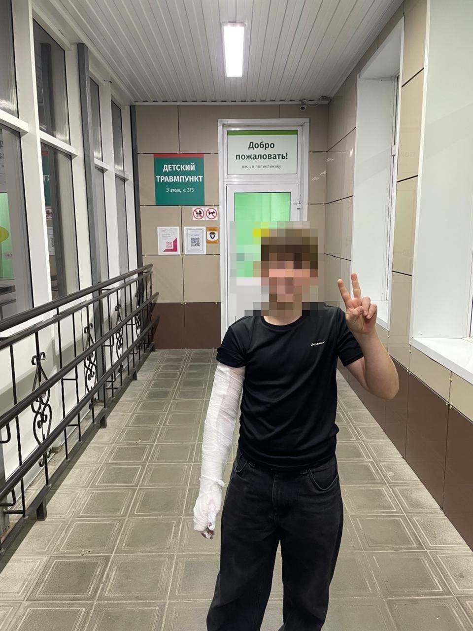 Куда едешь в Барнауле пенсионерка сломала руку подростку на велосипеде В редакцию телеканала Катунь 24 обратились родители малолетнего ребенка ставшего жертвой нападения женщины в центре краевой столицы Сейчас семья разыскивает свидетелей происшествия Телефон законных представителей мальчика есть в редакции По словам родителей 1 октября между 18 40 и 19 00 в районе дома 28 на улице Молодежной общежитие АГУ неизвестная женщина напала на 12 летнего подростка ехавшего на велосипеде В результате нападения ребенок получил перелом руки Подробности инцидента таковы Группа из трех друзей возвращалась из велосипедной мастерской Двое ребят проехали участок пути без помех но их друг Петр имя изменено который ехал последним стал жертвой немотивированной агрессии Со слов пострадавшего женщина на вид 65 лет которой не понравилось что проехали дети резко схватила его велосипед за руль Из за возникшей инерции подросток не удержал равновесие и упал на асфальт Увидев последствия своего поступка нападавшая не стала помогать ребенку и немедленно скрылась с места происшествия Рука у Петра болела очень сильно Родители сразу отвезли сына в травмпункт где врачи диагностировали серьезную травму перелом локтевого отростка Такие повреждения требуют длительного лечения и реабилитации