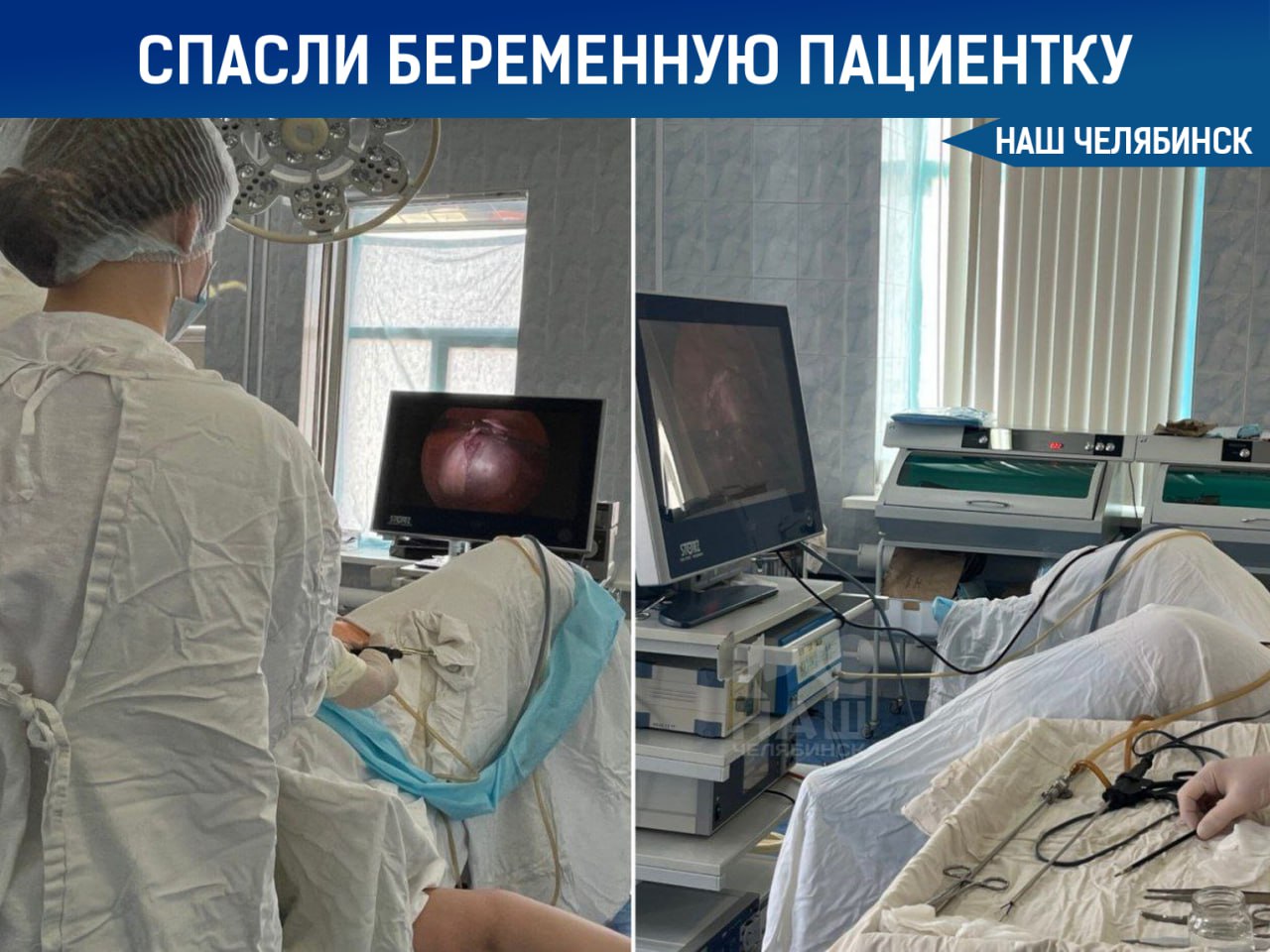 Врачи провели редкую операцию беременной женщине Гинекологи ГКБ 1 диагностировали 25 летней девушке на 22 й неделе беременности перекрут придатков матки осложнённый отмиранием тканей Операция позволила избежать тяжелых последствий включая перитонит и прерывание беременности Операцию провели хирурги гинекологи Татьяна Тюкова и Юлия Беляева Сейчас пациентка чувствует себя хорошо беременность развивается благополучно Такие случаи встречаются крайне редко не более 5 на 10 тысяч беременностей Наш Челябинск только самое важное про город Подпишись
