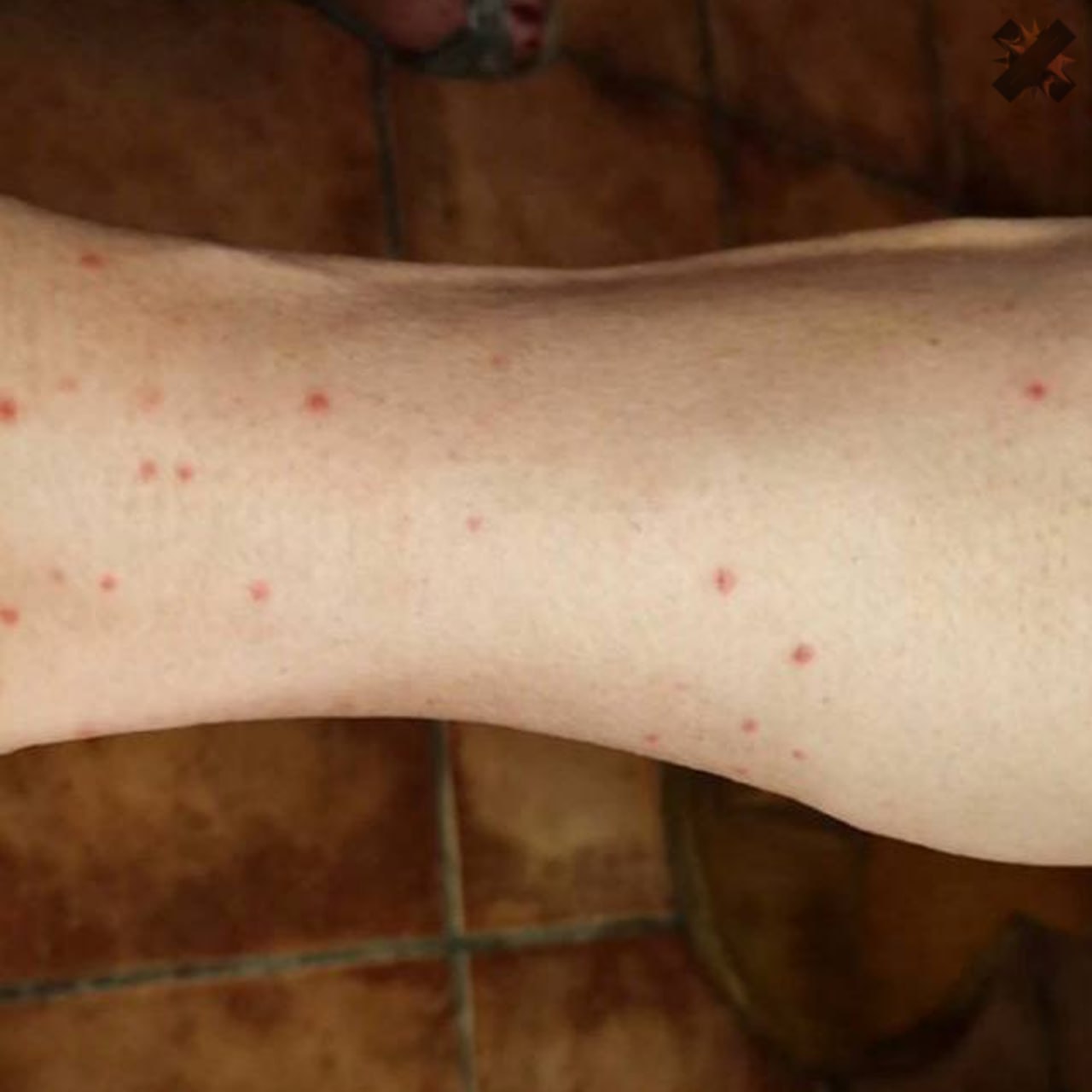 В элитных отелях Египта нашествие клопов россияне массово жалуются на укусы Насекомых находят в гостиницах Хургады Шарм эль Шейха и Сахль Хашиша в том числе в популярном Flow Spectrum Resort Гостей переселяют но клопы переезжают вместе с ними в новых номерах находят то же самое Туроператоры признают это худшая ситуация за последние 10 лет Туристы боятся привезти клопов домой в чемоданах а укусы у многих вызывают сильную аллергию в Египет пока не едем надеюсь решат проблему НМШ