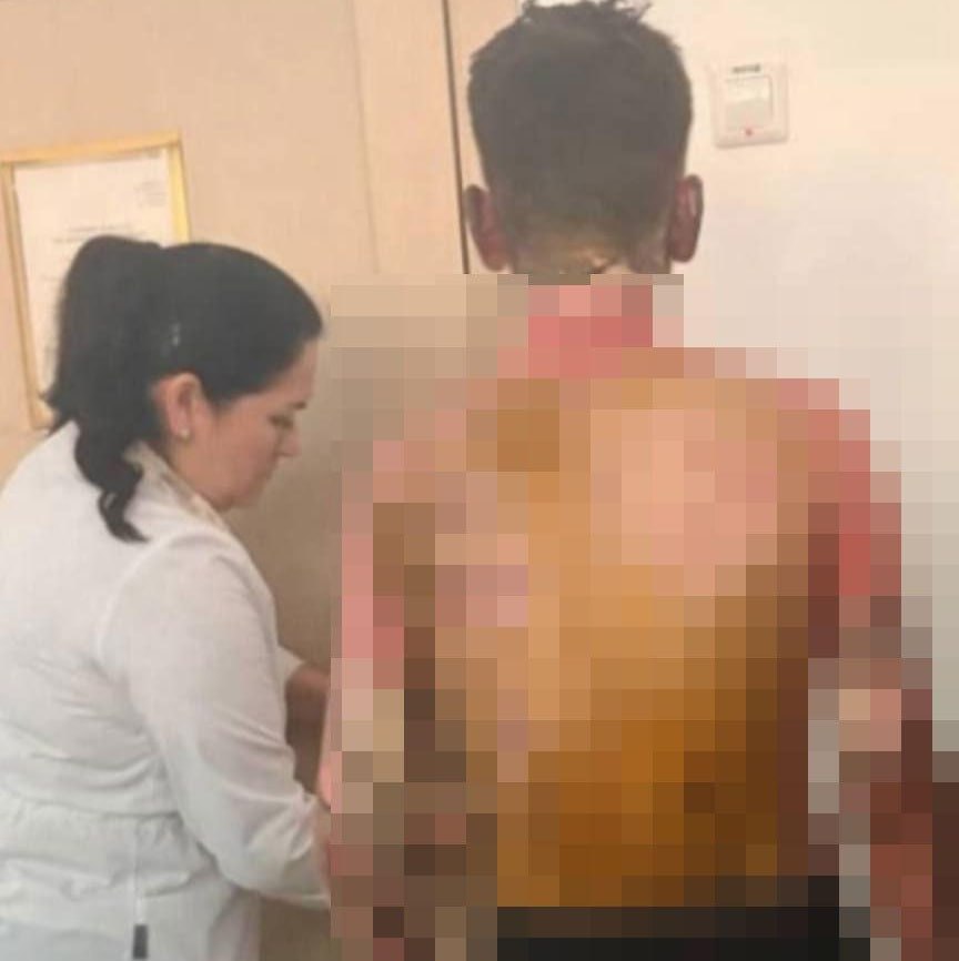 Красноярская восьмиклассница облила другого школьника бензином и подожгла Baza Помимо этого она нападала на других учеников с молотком пока её не задержали Пострадавшие госпитализированы А что ещё случилось