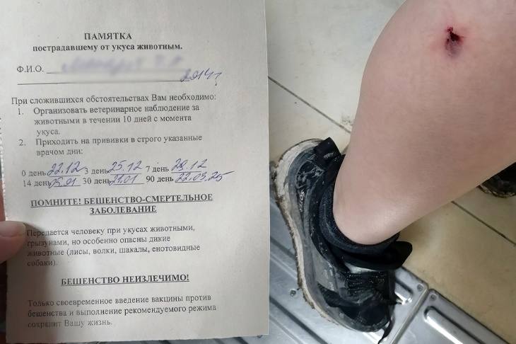 «Страх на всю жизнь»  На юге Волгограда дворняжка укусила 10-летнего ребенка  В Красноармейском районе Волгограда бездомная собака прокусила ногу 10-летнему мальчику, который проходил мимо стаи животных. Как сообщила мама несовершеннолетнего Алина Макарова, происшествие с её сыном случилось средь бела дня в воскресенье, 22 декабря.   - В 12 часов дня он пошел на улицу, на детскую площадку. Шёл по тропинке, а в метрах пяти от тропинки были собаки, их женщина кормила. Одна черная собака подбежала к моему сыну и кусанула его за ногу. На что женщина ее окликнула, что, дескать, так нельзя делать. Мой сын в шоке. Сразу позвонил мне и мы побежали в травмпункт, - рассказала V102.RU волгоградка.  По словам женщины, ее ребенок не обратил внимание, были ли чипированы животные.     Подробнее