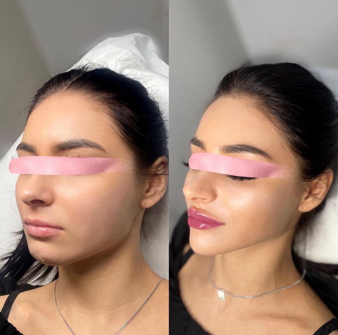 Половина россиян доверяет только рекламе с эффектом до после исследование Getblogger Наглядность результата ключевой фактор доверия к рекламе для 48 россиян Также доверие повышают репутация бренда 41 реальные истории клиентов 34 уникальность и оригинальная подача контента 31 К сожалению многие бренды и косметологические клиники недобросовестно используют эффект до после демонстрируя заведомо нереалистичный результат Это особенно заметно на маркетплейсах и в запрещённой социальной сети Чаще всего потребители обращают внимание на рекламу косметики и бьюти процедур на маркетплейсах 41 в СМИ 31 и в соцсетях или на сайтах 30 Несколько реже в торговых центрах 25 на наружных носителях 17 и в мобильных приложениях 16 Как мы уже обсуждали ранее сейчас актуален подход меньше слов больше дела И статистика это подтверждает доверие к обещаниям о натуральности снижается 56 опрошенных считают такие заявления всего лишь маркетинговым ходом в то время как важнее формула средства поэтому важно добавлять на упаковку QR коды Однако 25 россиян всё же уверены что натуральные компоненты эффективнее и безопаснее синтетических аналогов Цена красоты