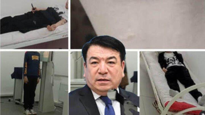 Мальчика жестоко избили одноклассники в сельской школе Ученик седьмого класса в селе Индербор получил сотрясение мозга. Родственники пострадавшего рассказали, что произошло это в школе и сейчас дело якобы пытаются замять. «Дело хотят закрыть, потому что им нет 16. Но мальчика избили по-взрослому. Родственники тех, кто напал, приходили с извинениями. Но мы требуем, чтобы виновные понесли наказание». В отделе образования назначили служебную проверку в школе. «По итогам будут приняты соответствующие меры. Информация направлена в уполномоченные органы в установленном порядке», — заверили чиновники. В полиции на запрос редакции сообщили о начале следствия. Обещают допросить всех подростков, причастных к избиению: «По факту причинения телесных повреждений несовершеннолетнему в Индерском районе зарегистрировано уголовное дело. В связи с тем, что участники происшествия несовершеннолетние, допрос будет проводиться с участием их законных представителей». Агрессоров могут поставить на учёт. Также с ними будет разбираться комиссия по делам несовершеннолетних. Об избиении несовершеннолетних в школьном туалете в селе Караой мы писали здесь. • Фото: соцсети.