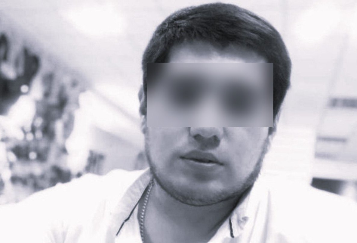 Перед операцией на носу в одной из частных клиник Ташкента умер мужчина repost uz rodnie schitayut iz za narkoza Подписывайтесь на Repost