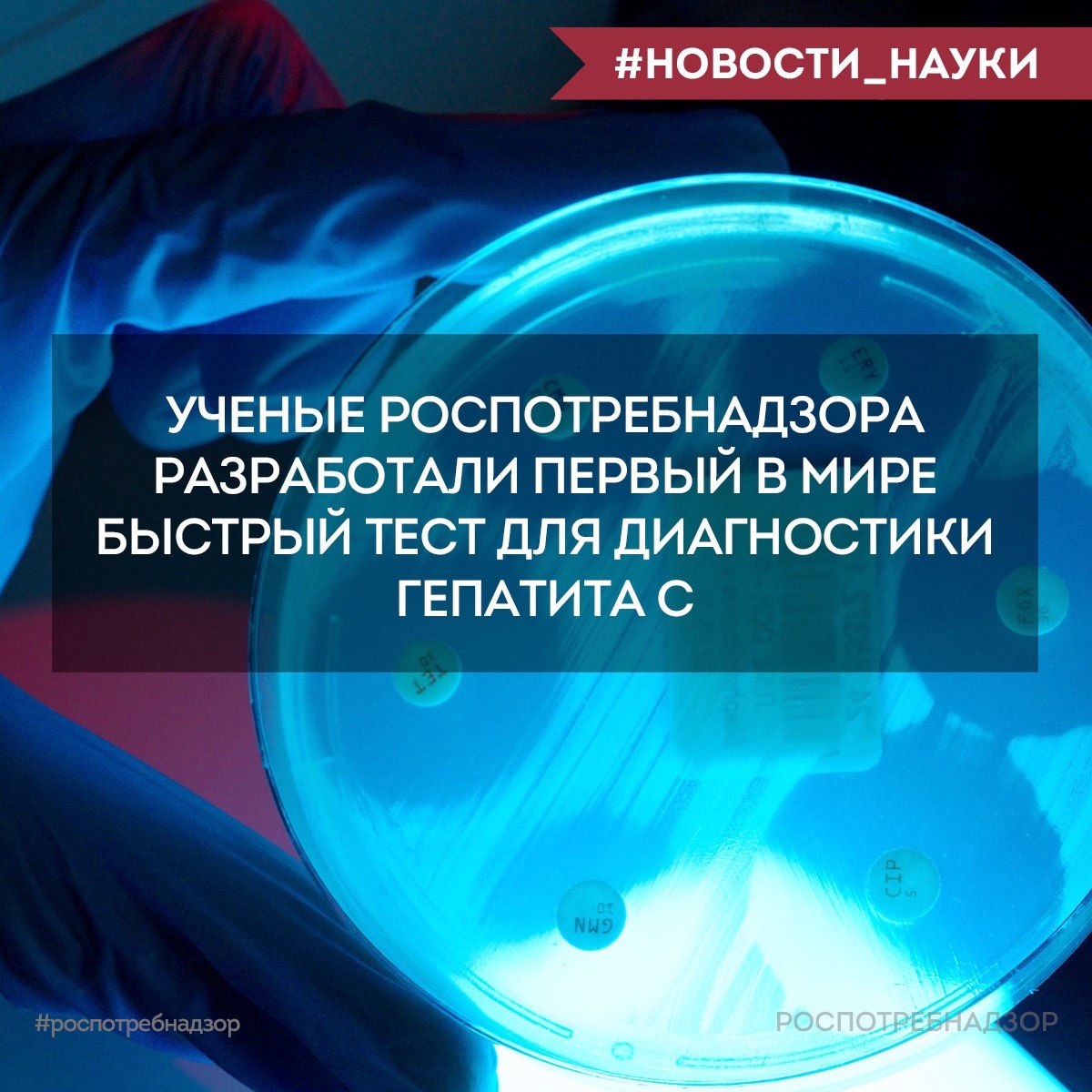 Роспотребнадзор VK В России создан первый в мире быстрый тест для диагностики гепатита С Ученые ФБУН ЦНИИ Эпидемиологии Роспотребнадзора зарегистрировали первый в мире быстрый тест для диагностики вирусного гепатита С на основе петлевой изотермической амплификации LAMP Гепатит С инфекционное заболевание способное вызвать цирроз и рак печени Особенно опасен для людей с ослабленным иммунитетом Теперь диагностика вирусного гепатита С занимает всего 2 5 3 0 минут вместо 1 5 2 часов Быстрая и точная диагностика имеет важное значение для скрининговых мероприятий оперативного выявления больных а также для назначения эффективной терапии и принятия противоэпидемических мер Разработка проводилась в рамках Федерального проекта Санитарный щит страны безопасность для здоровья предупреждение выявление реагирование