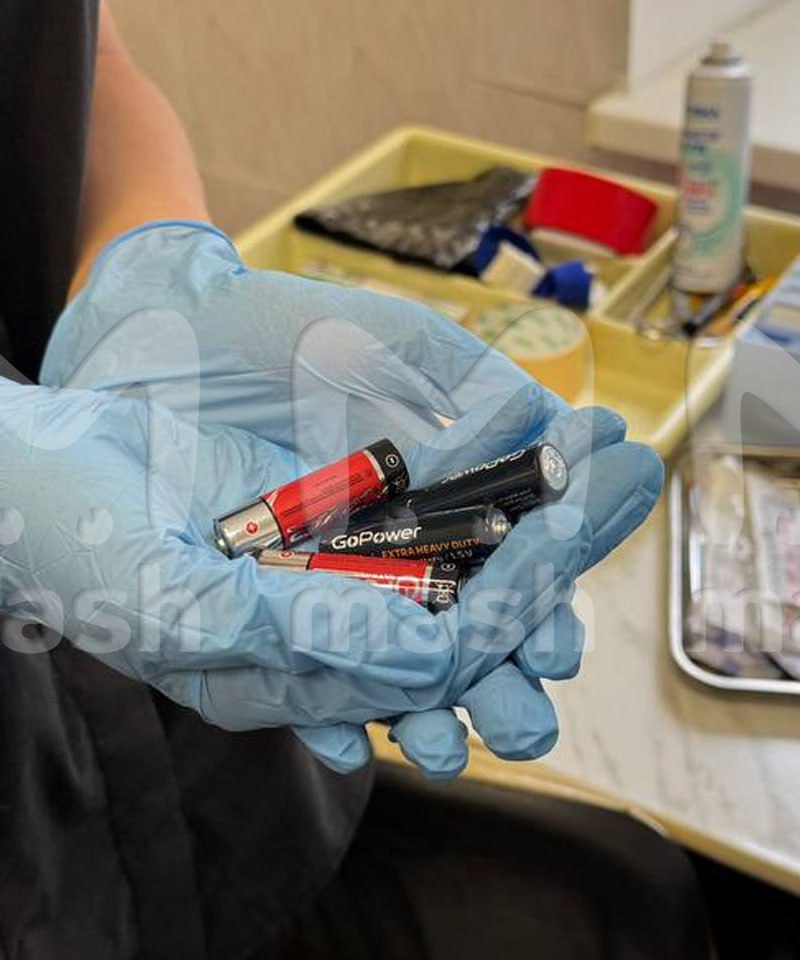 Житель Уфы вставил себе пальчиковые батарейки в анус, чтобы «получить заряд бодрости», пишут Mash 30-летний мужчина поступил в приемный покой с жалобами на боль в заднем походе. Оказалось, что у него там четыре пальчиковые батарейки. Он рассказал, что выпил пива дома, а затем решил получить заряд бодрости. Достать сам не смог. Врачи извлекли ему батарейки и прописали лечение. ВПШ