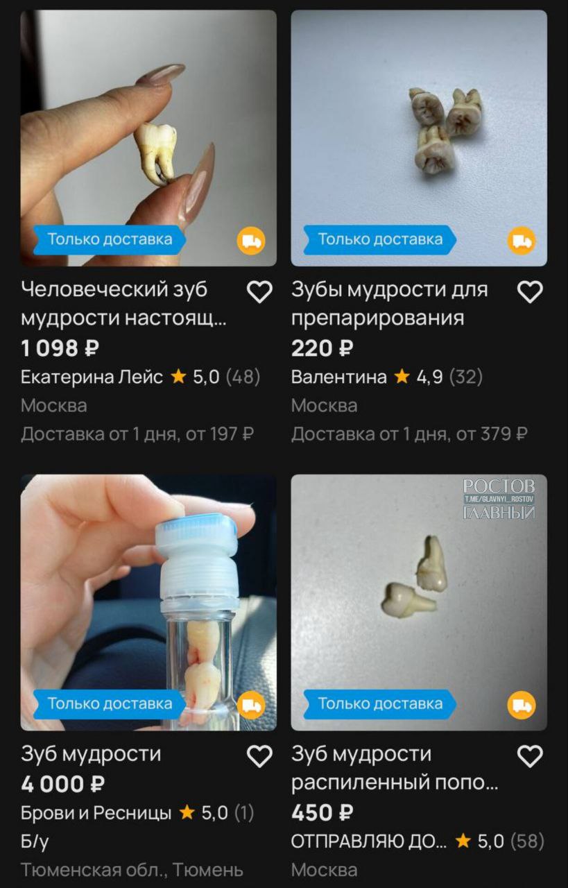 Россияне массово продают зубы мудрости За один предлагают до 3000 руб с кариесом около 500 руб в идеальном состоянии дороже в несколько раз Основные покупатели студенты стоматологи для учебной практики часть спроса формируют любители украшений превращающие зубы в кулоны кольца и элементы декора glavnyi rostov Присылайте ваши фото видео новости мне в лс glavnyi admin РГ в МАХ