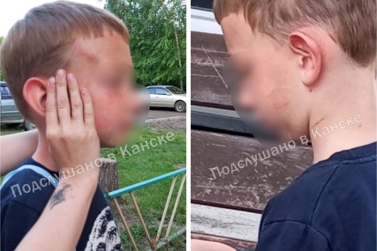 Соседи считают, что мальчика избивает мать: жители Канска увидели во дворе ребенка в синяках и ссадинах и забили тревогу. После того, как соседи избитого мальчика выложили шокирующие фотографии в соцсетях, полиция начала проверку. В истязании шестилетнего мальчика подозревают его 37-летнюю мать. Известно, что женщина одна воспитывает двоих сыновей-дошкольников. Их уже изъяли из семьи. Кстати, раньше она не попадала в поле зрения правоохранительных органов. : vk.com/p_v_k_kansk